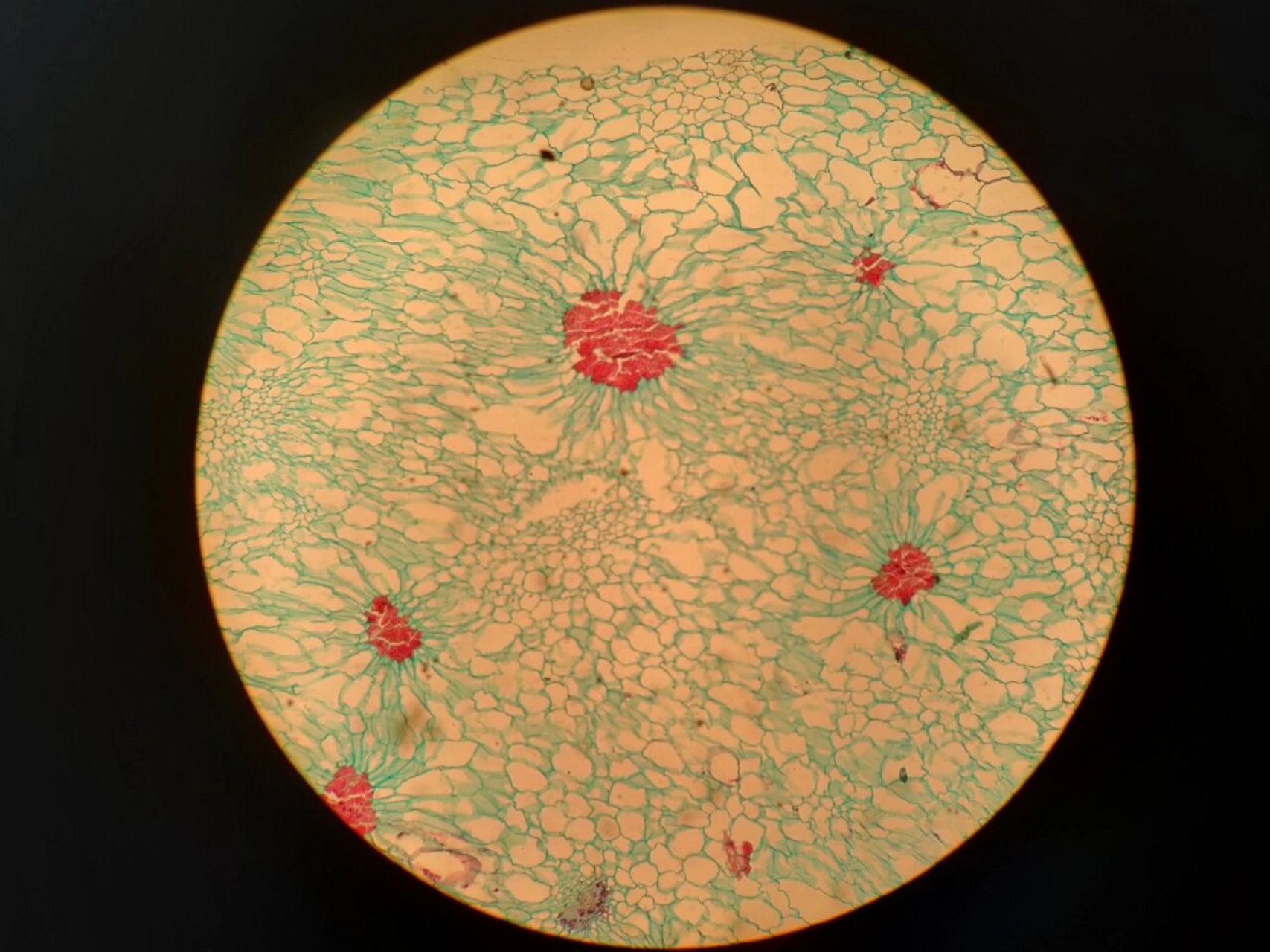梨果实切片示石细胞 植物学实验