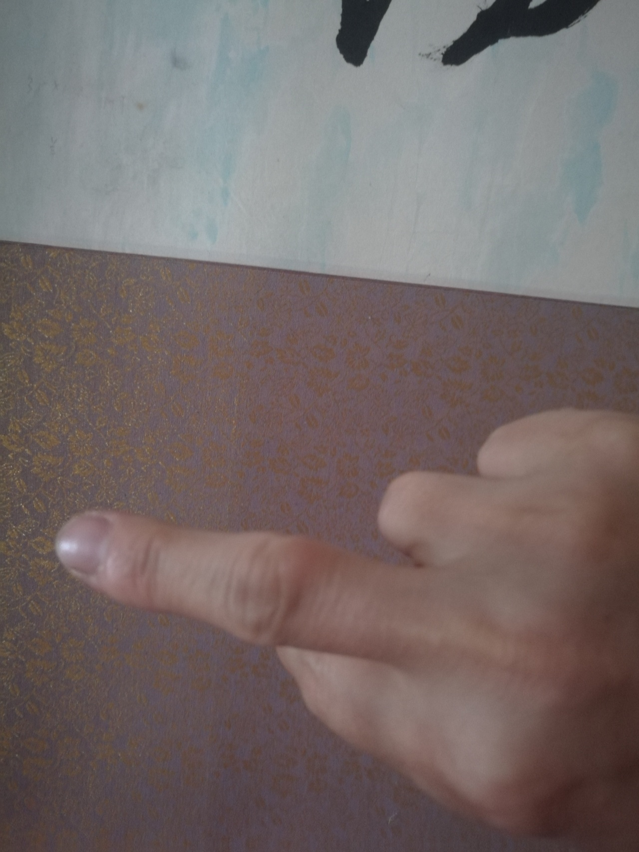 右手中指关节长个小包是什么 最近发现手指关节长个小包,不痛不痒的