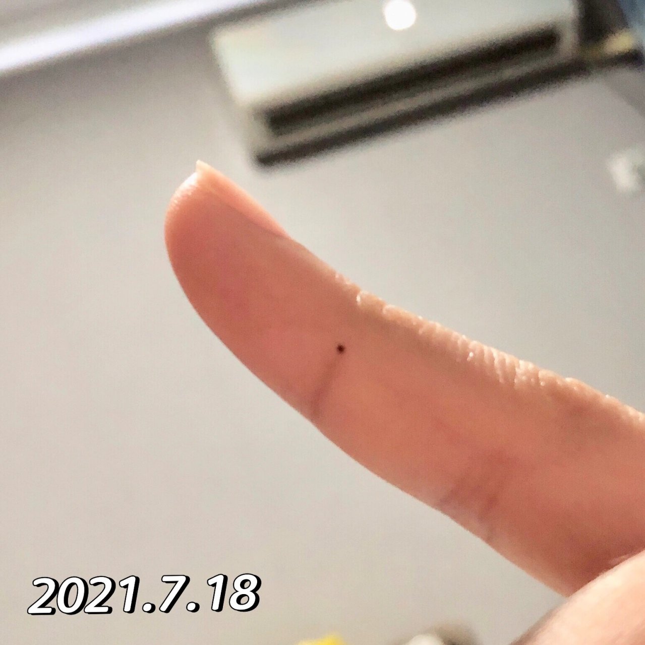 真的会长痣啊 右手手指头侧面长了个痣,看着它越来越清晰 用手打字就