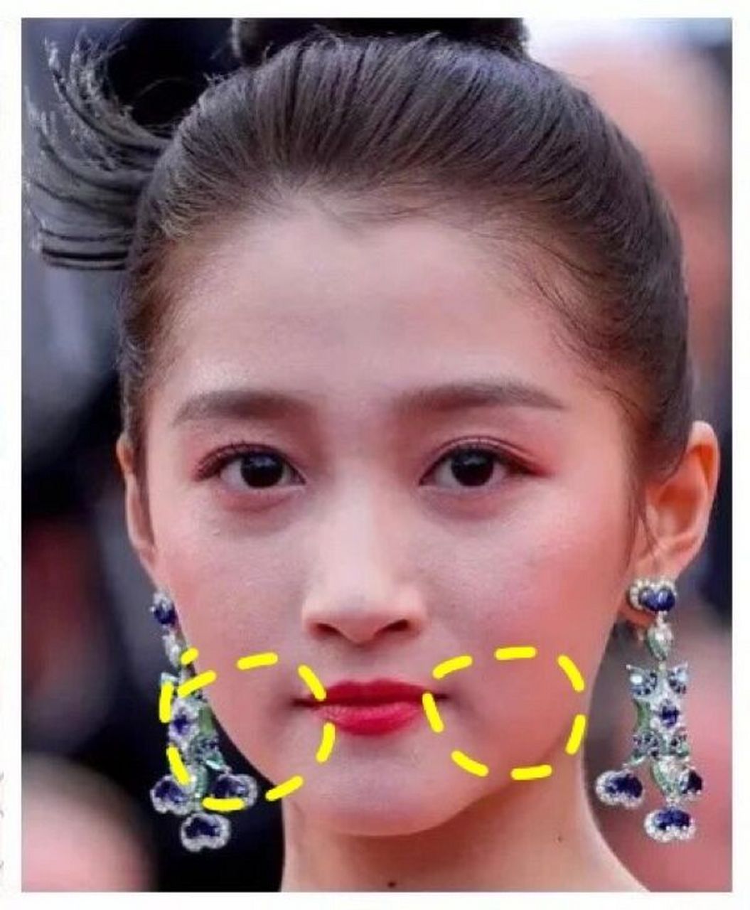 衰老必看!嘟嘟肉口角囊袋解决方案大全! 一说到衰老的表现,我们肯定会