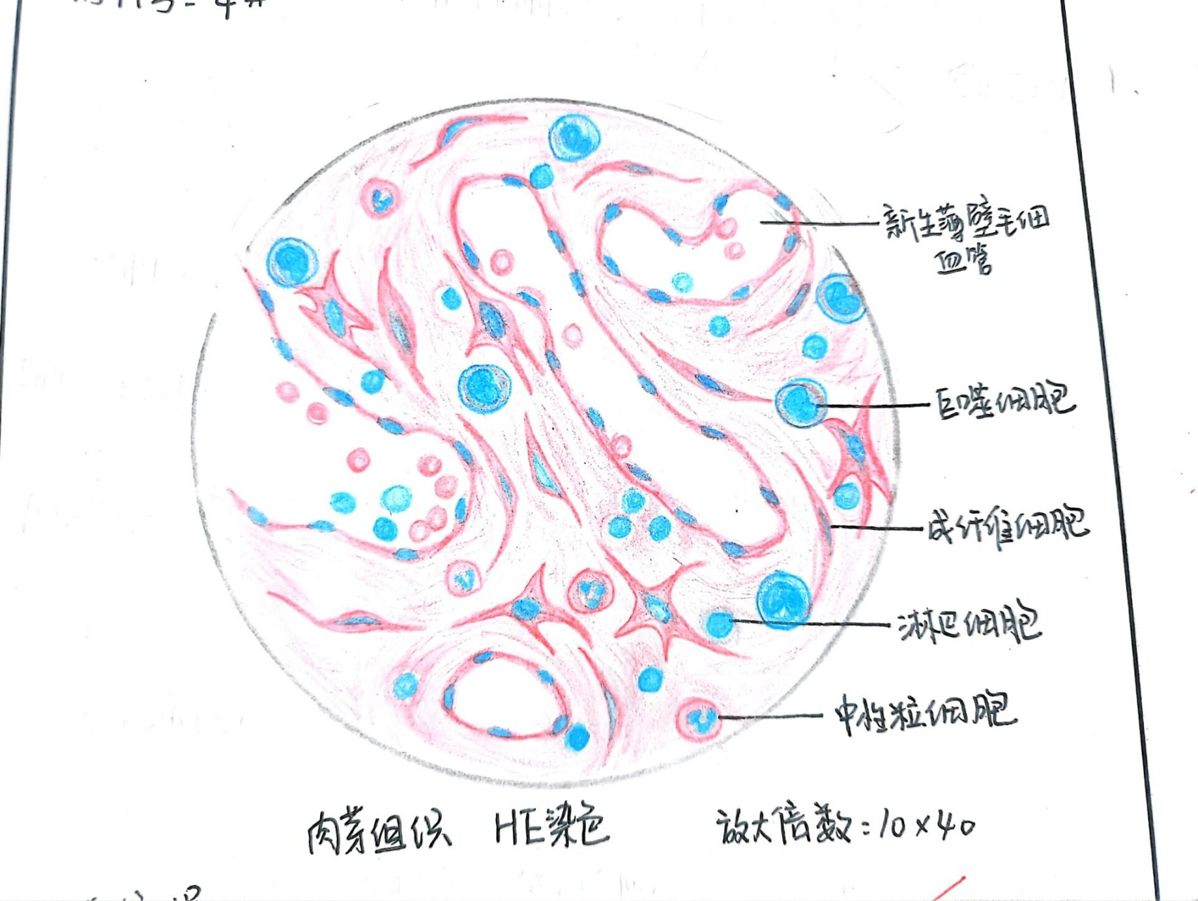 病理学实验绘图 肉芽组织 混合血栓