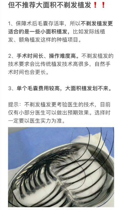 植发两万能植多少(2万植发能值多少单位)