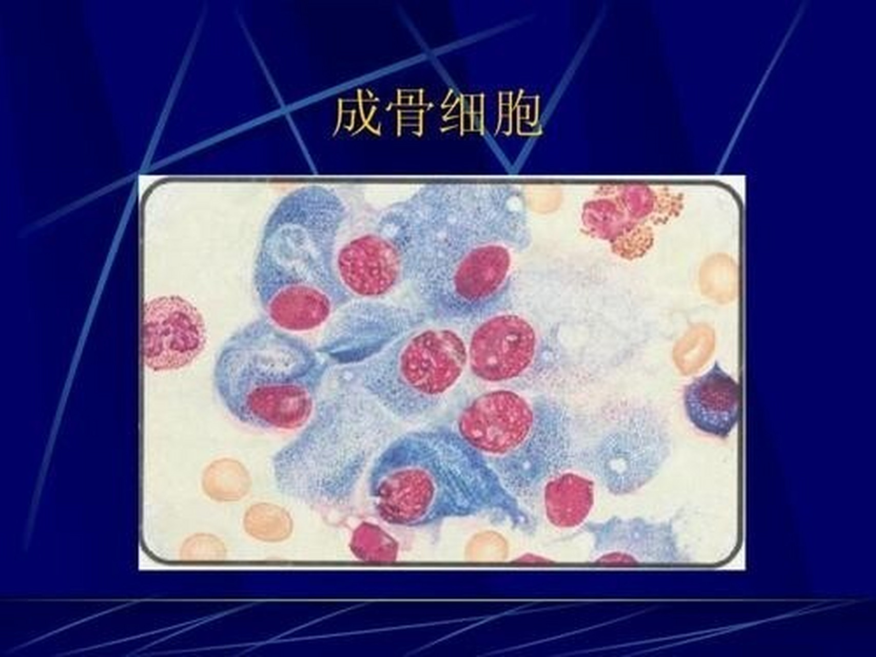 一,什么是成骨细胞,破骨细胞 成骨细胞是骨形成的主要功能细胞,负责骨