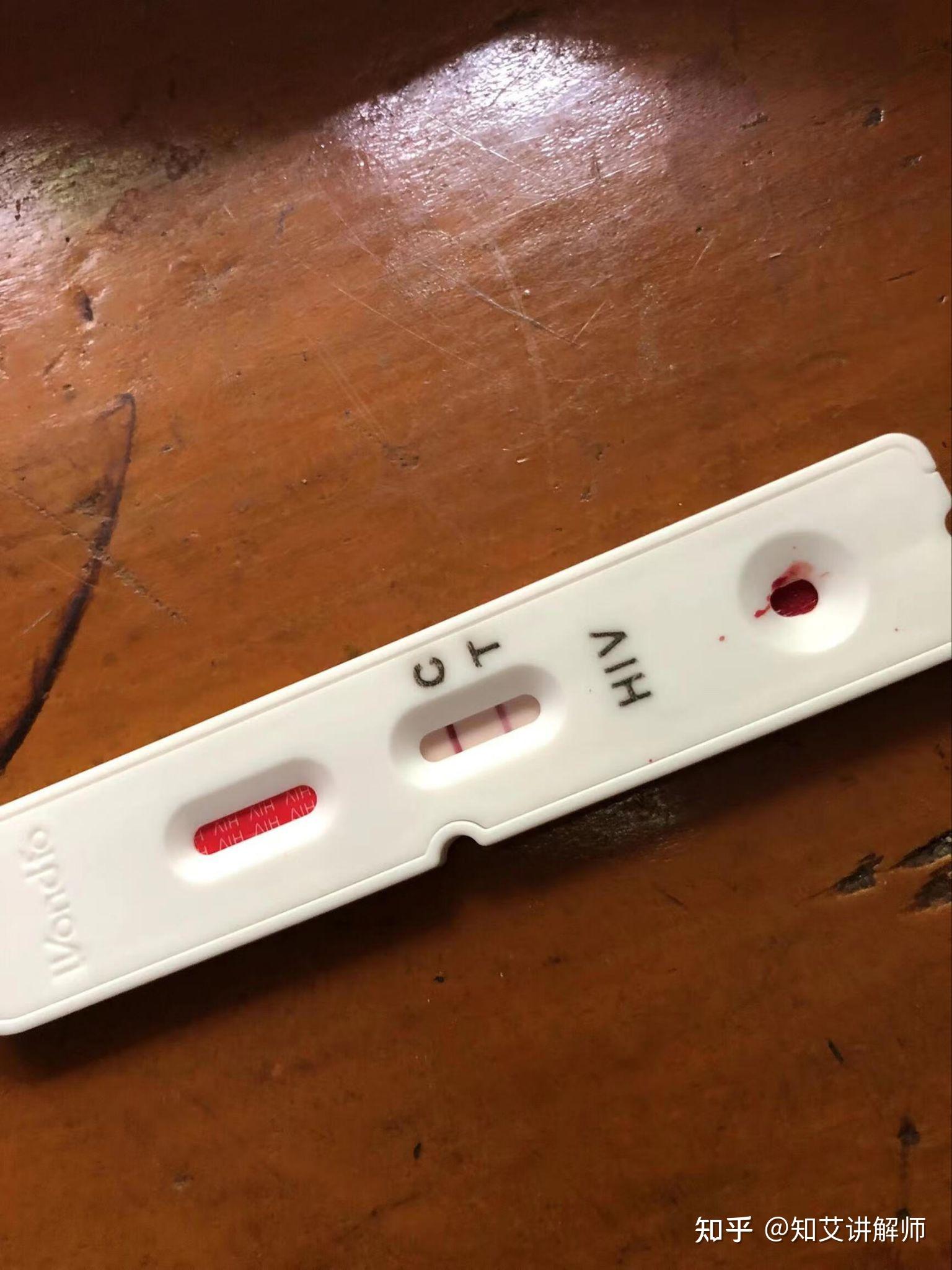 艾滋病试纸氧化是什么样子啊