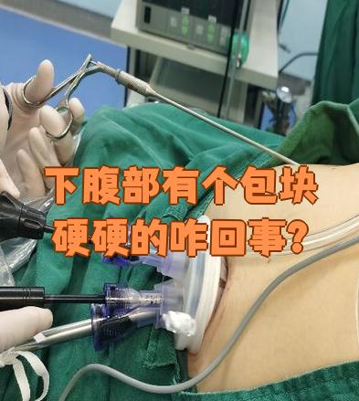 下腹部摸到硬硬的包块可能和多种疾病有关,比如小肠间质瘤,肠胀气