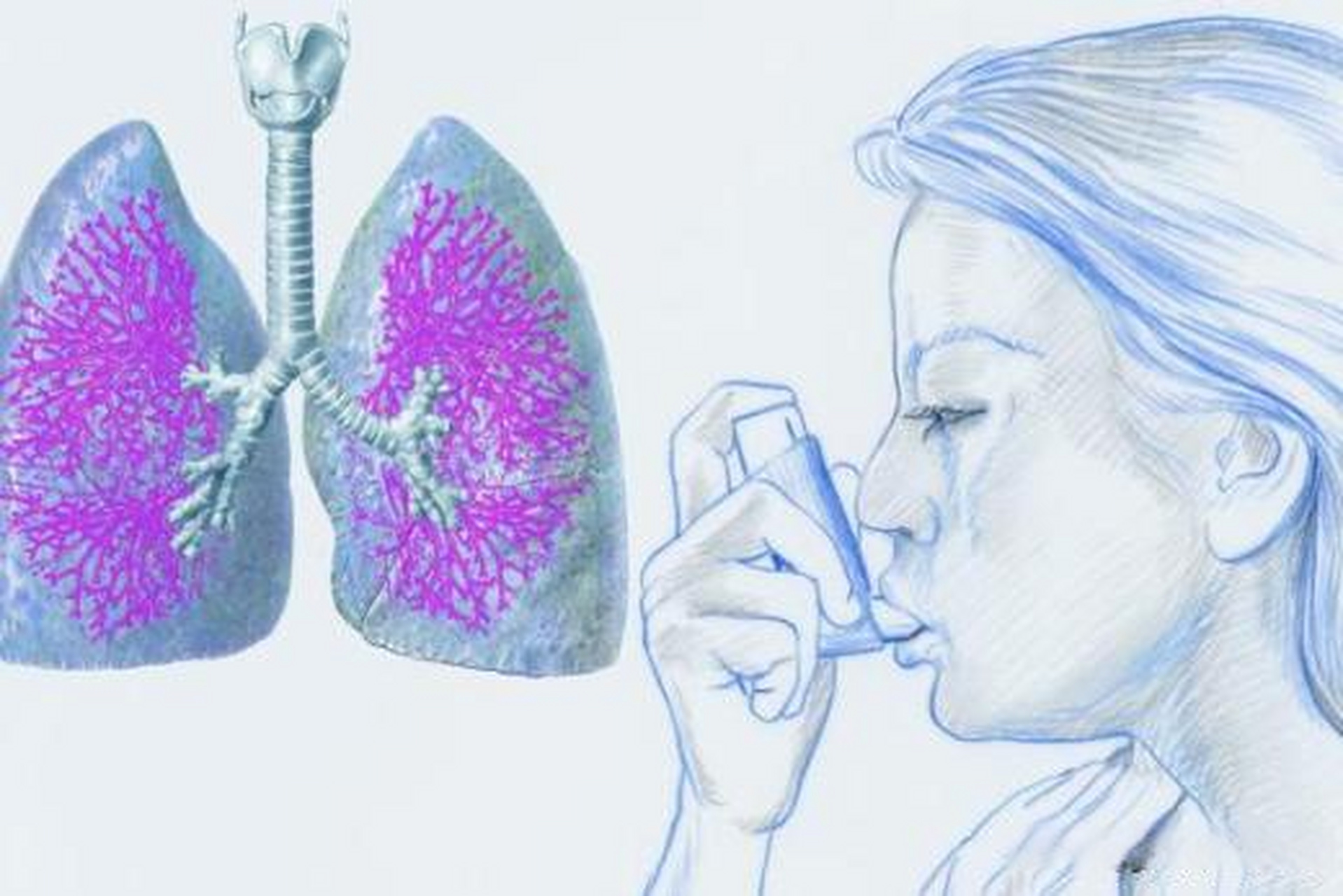 慢阻肺稳定期的治疗---β2受体激动剂 短效β受体激动剂主要有沙丁胺
