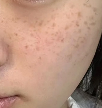 脸上有一圈黑色的轮廓怎么回事?