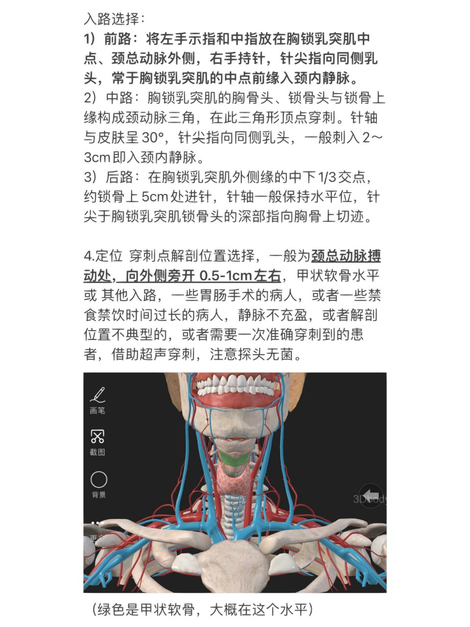 静脉穿刺的位置图解图片