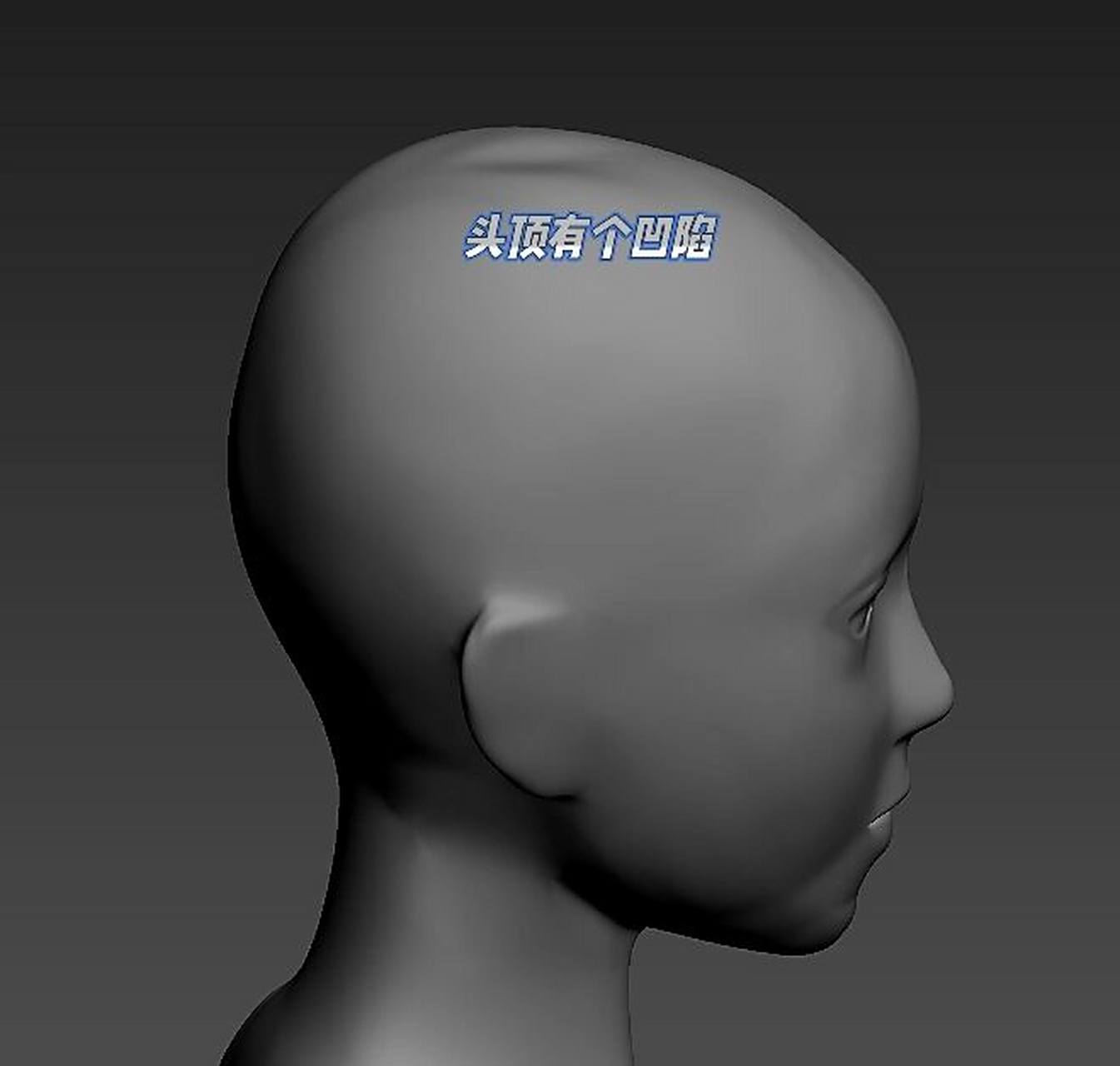 最近发现头顶有个凹陷 不知道怎么回事 最近摸到头顶有个凹陷.