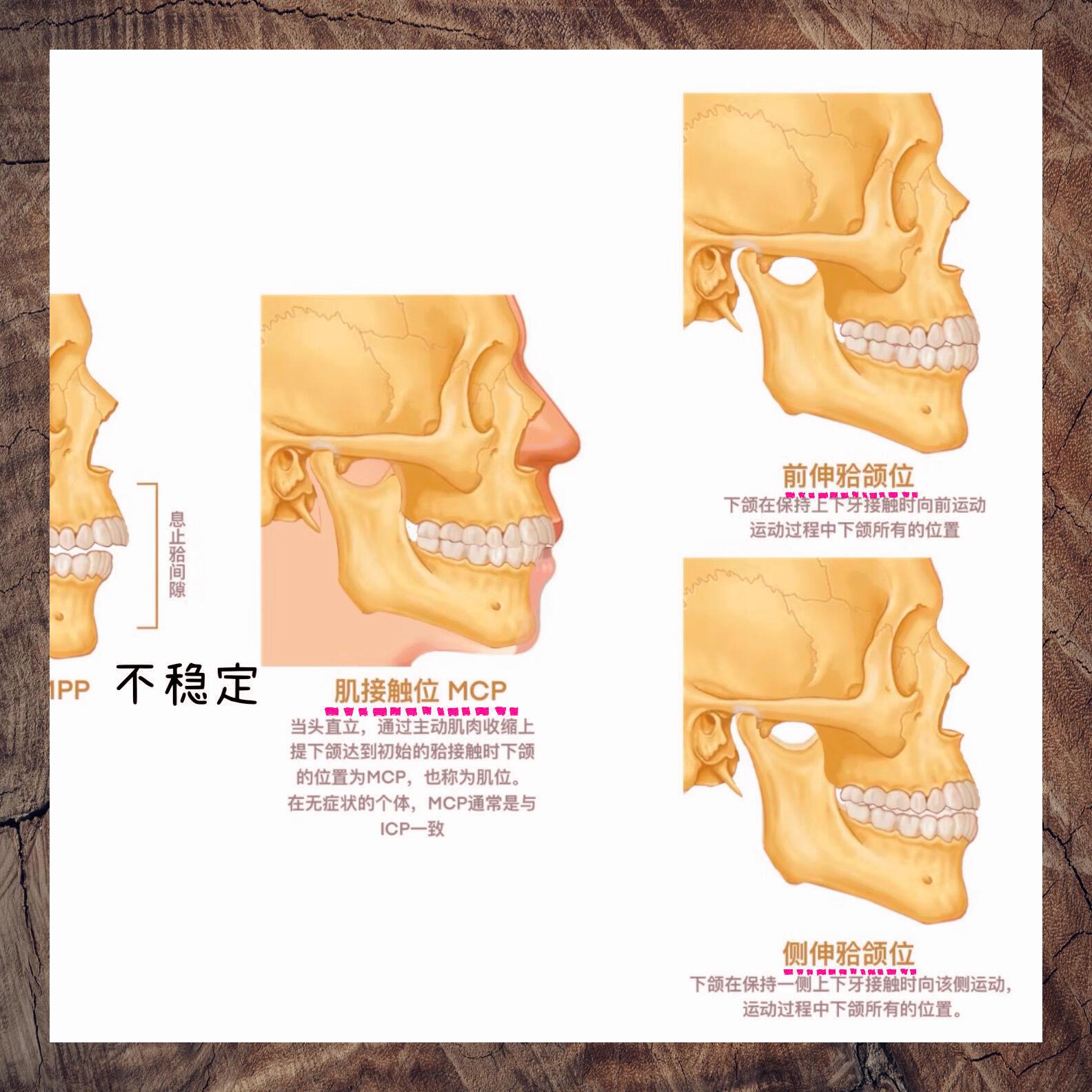 上颌骨与下颌骨位置图图片