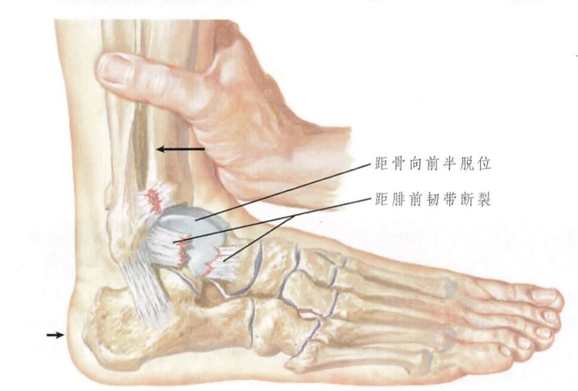足韧带位置示意图图片