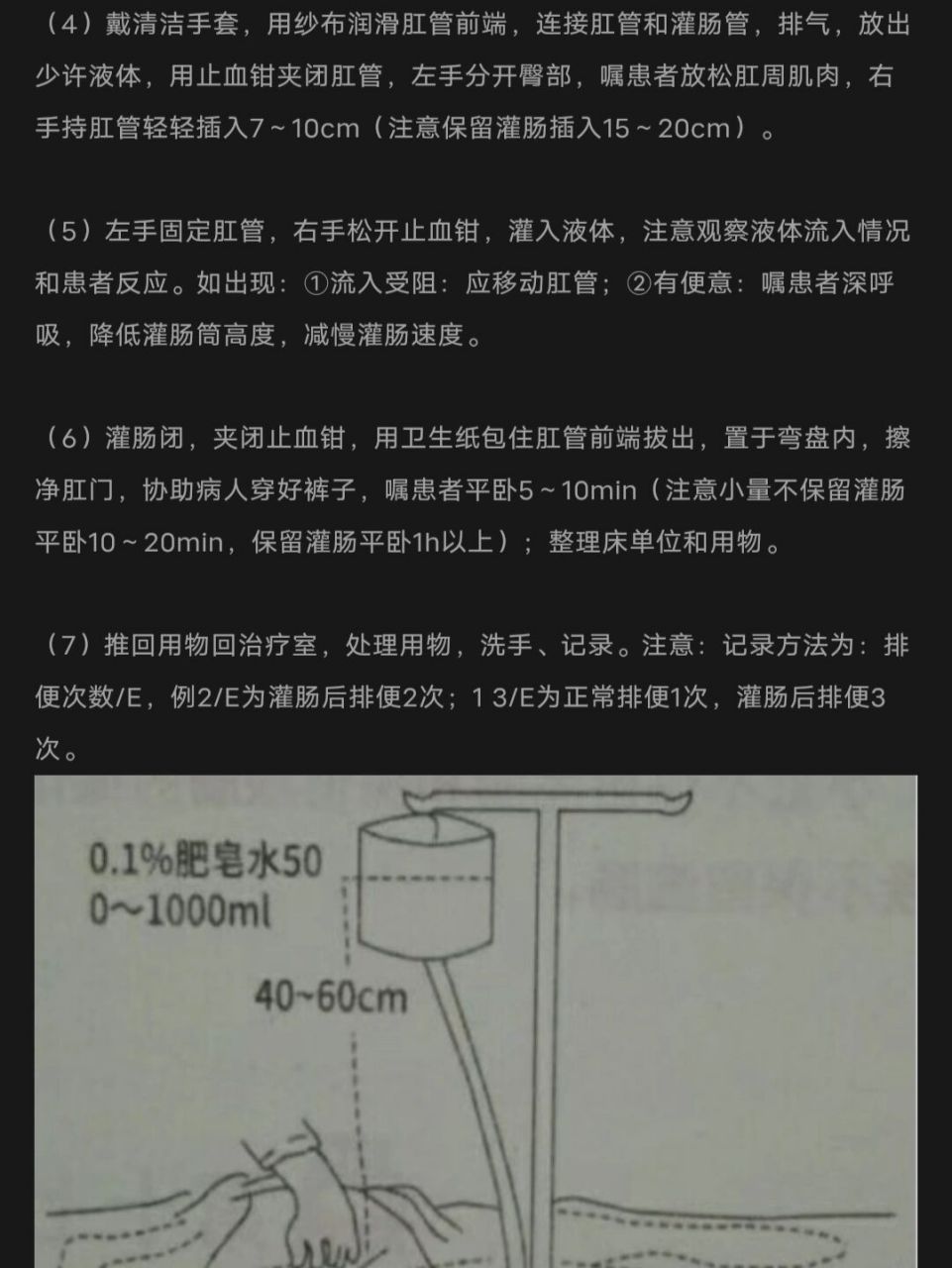 小量不保留灌肠图片