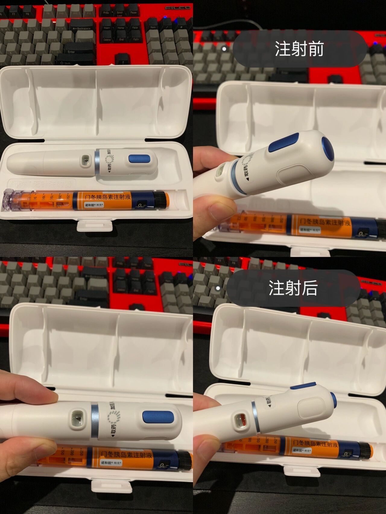 5  十多天快舒尔无针注射器使用感受分享 简明讲讲最直接的感受 1.
