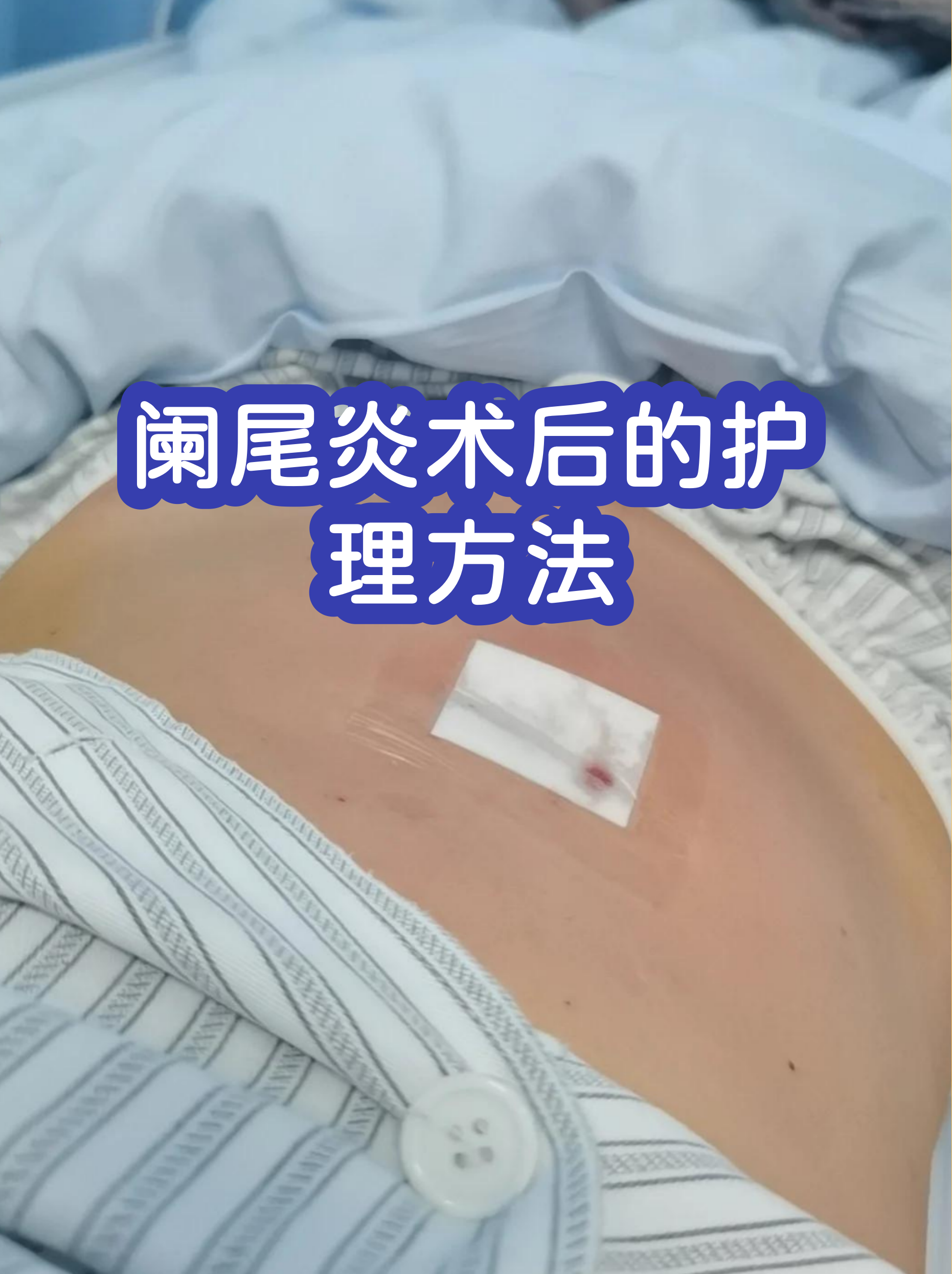 关于同仁医院代挂专家号加代问诊出院居家护理提醒，科学恢复身体的信息