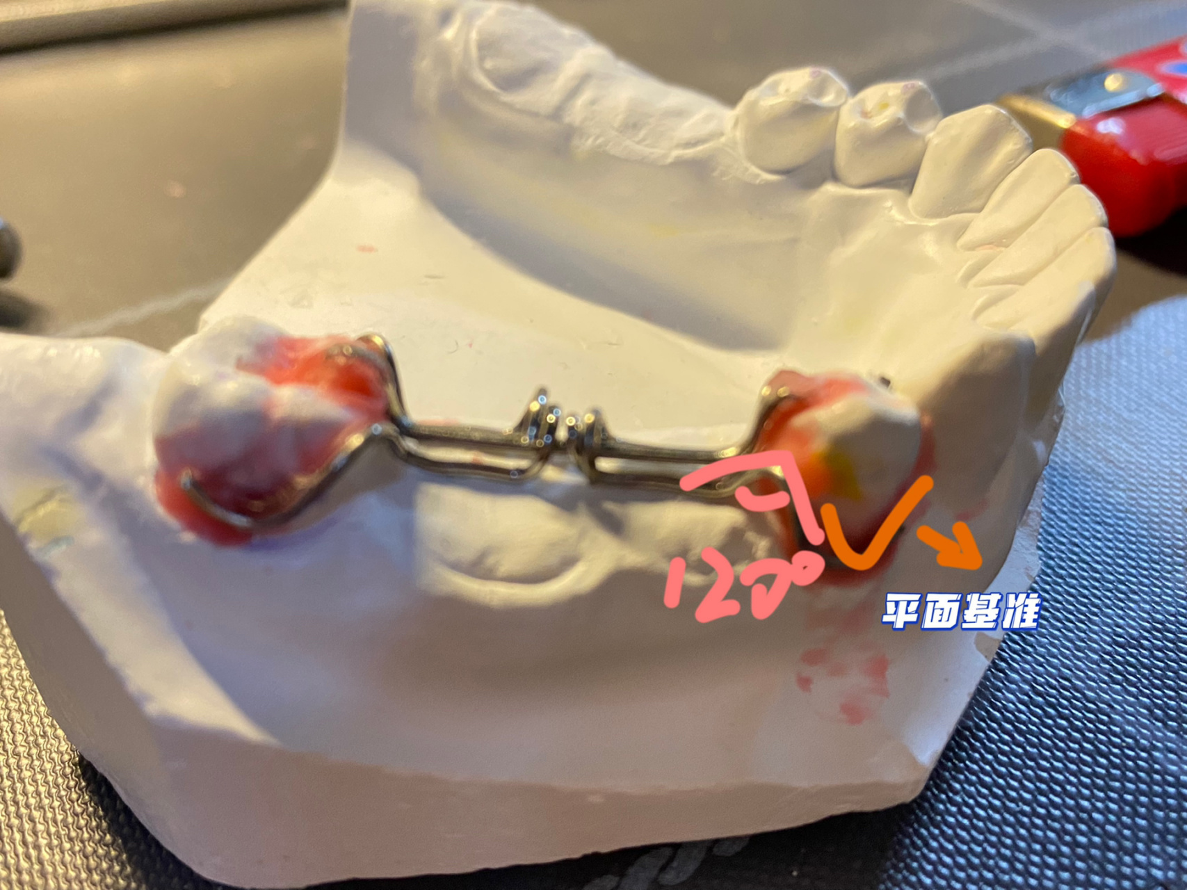 修复三臂卡环弯制实验,小技巧～ 卡环弯制好难01 一开始弄的时候