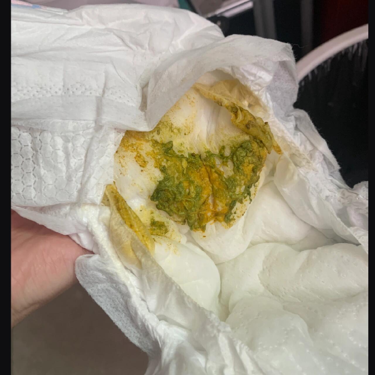 百度科普知识是: 1,腹部受凉 2,喂养不当 3,母亲饮食习惯吃过多的