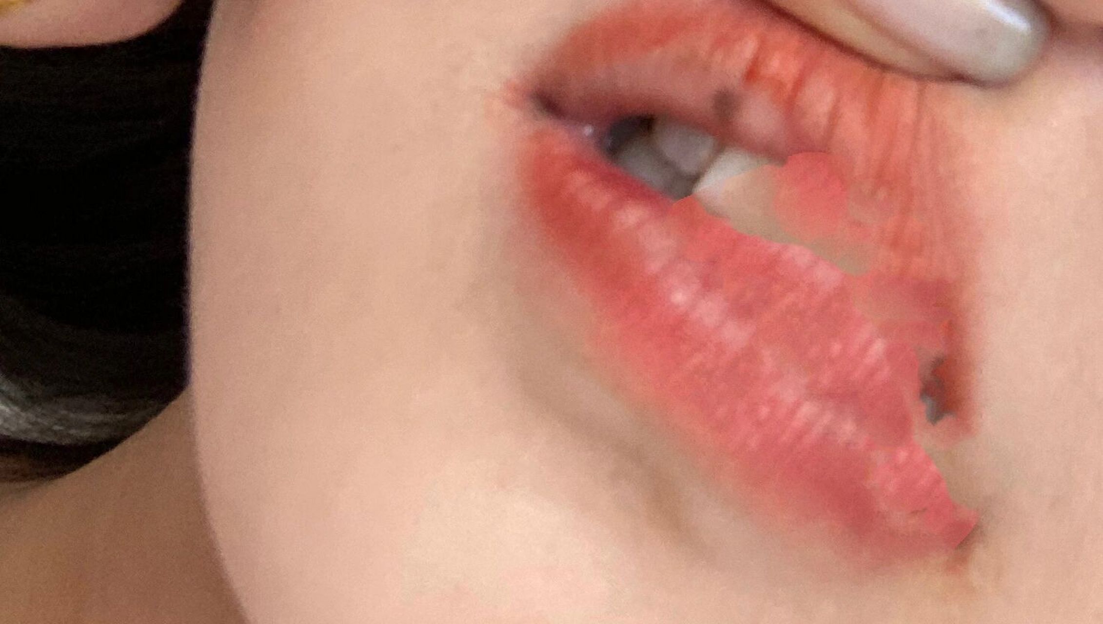 求求大家嘴唇上长这个黑点怎么回事