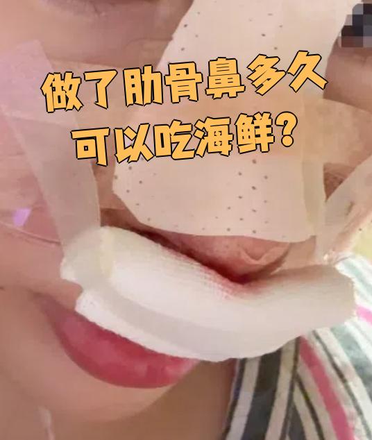 做完肋骨鼻手术后,一般建议30天后再吃海鲜,但具体时间要看伤口恢复