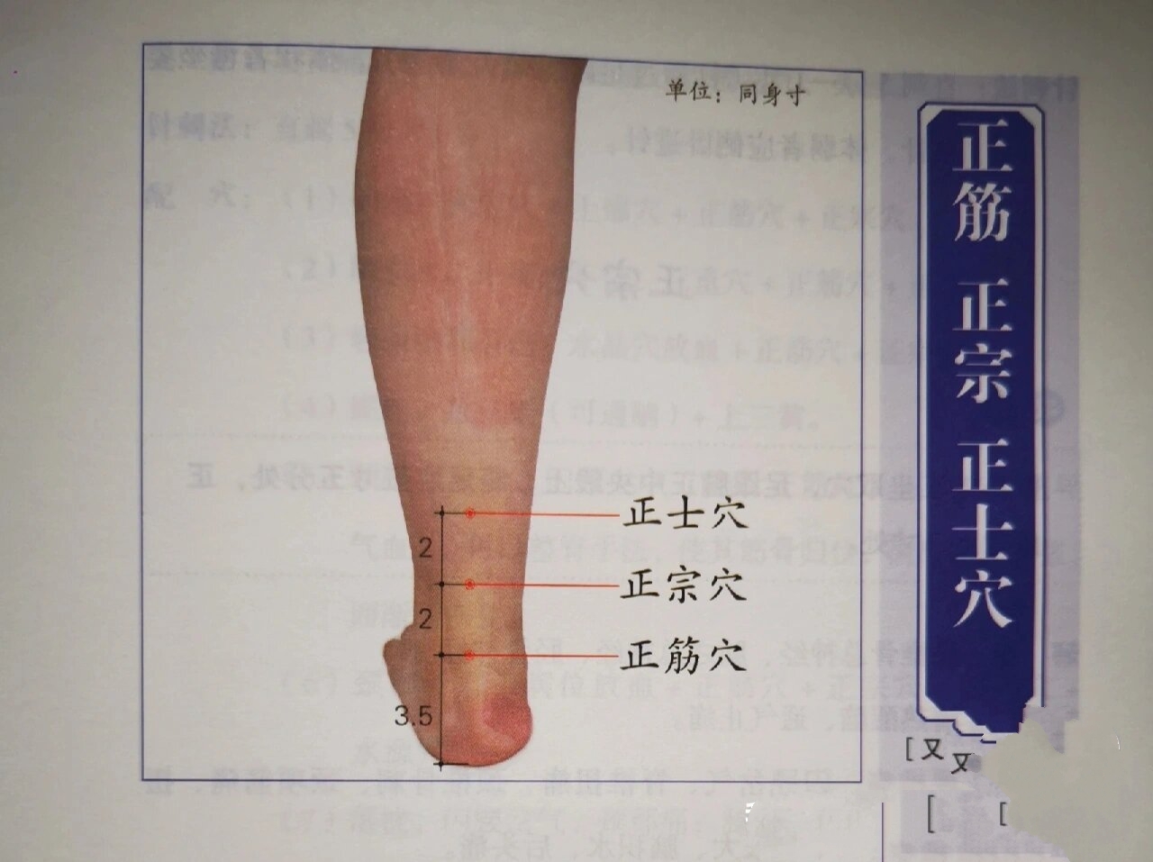 正士穴 则卧或正坐取穴,足跟腱正中央线上,正筋穴直上四寸,正宗穴直上