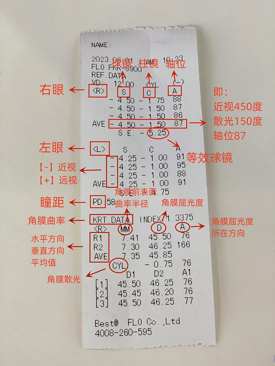 核心关键的就是: 球镜 = 近视 柱镜 = 散光 轴位 = 散光方向(有