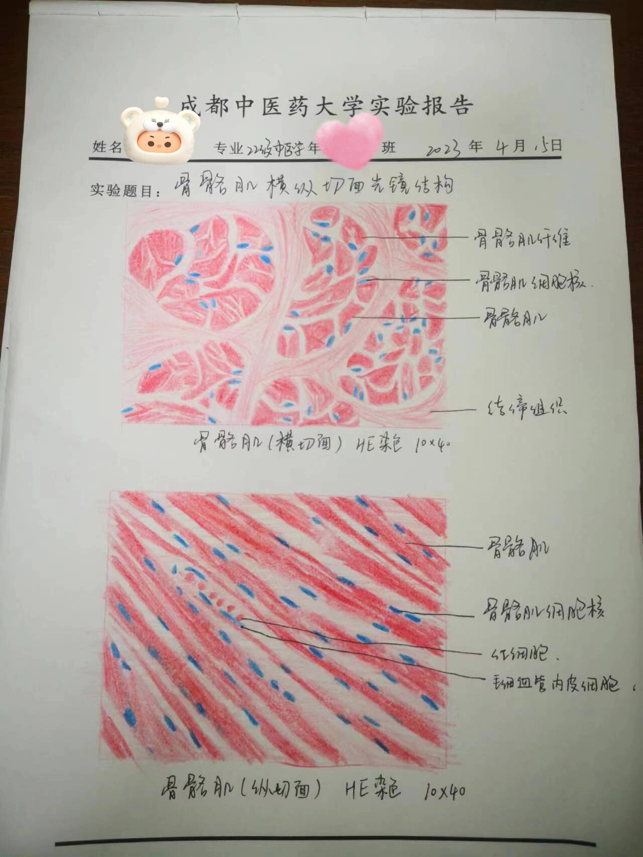 组胚-骨骼肌光镜结构红蓝铅笔绘图
