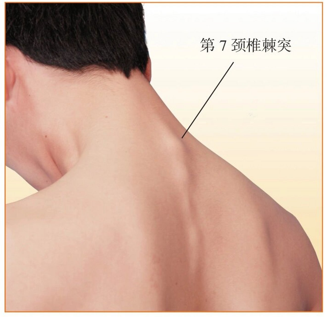 人体体表解剖全真图解/颈部体表标志 97枕外凸隆 枕鳞中央的骨性