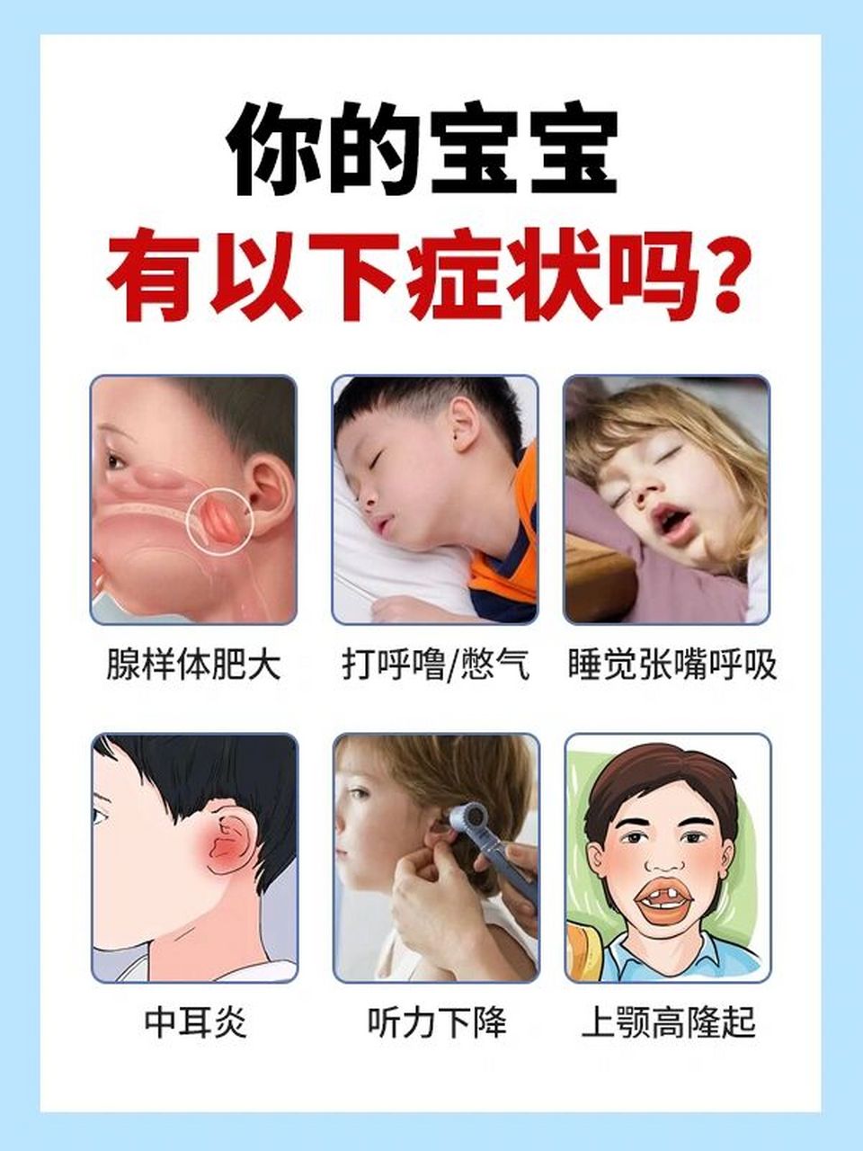 8715那腺样体肥大究竟