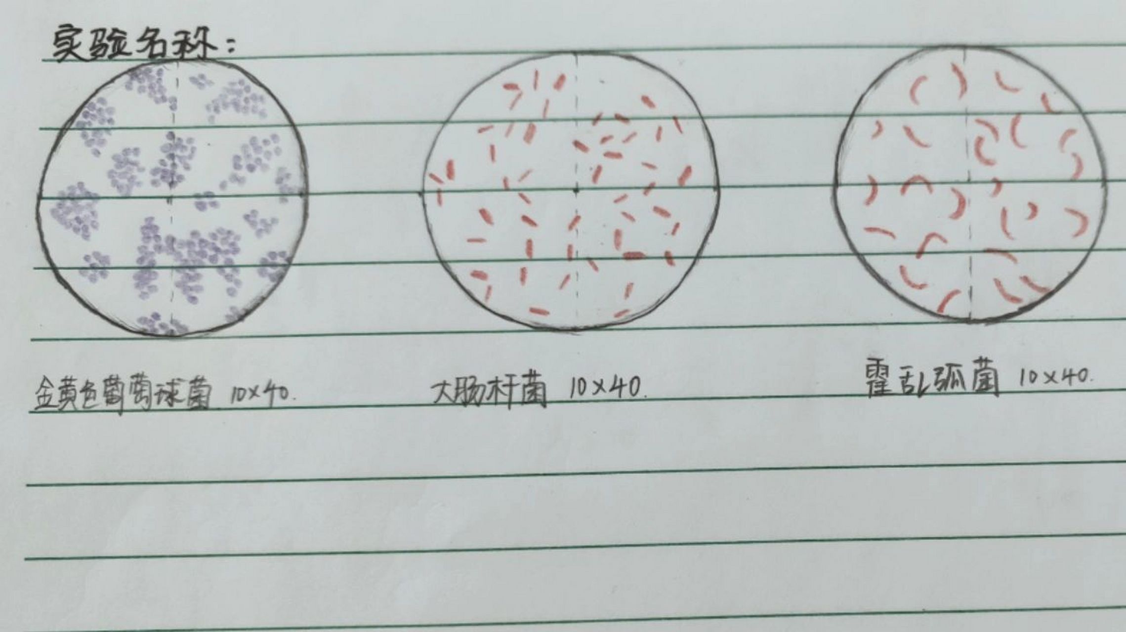 病理学细菌切片手绘图 金葡菌,大肠杆菌,霍乱弧菌