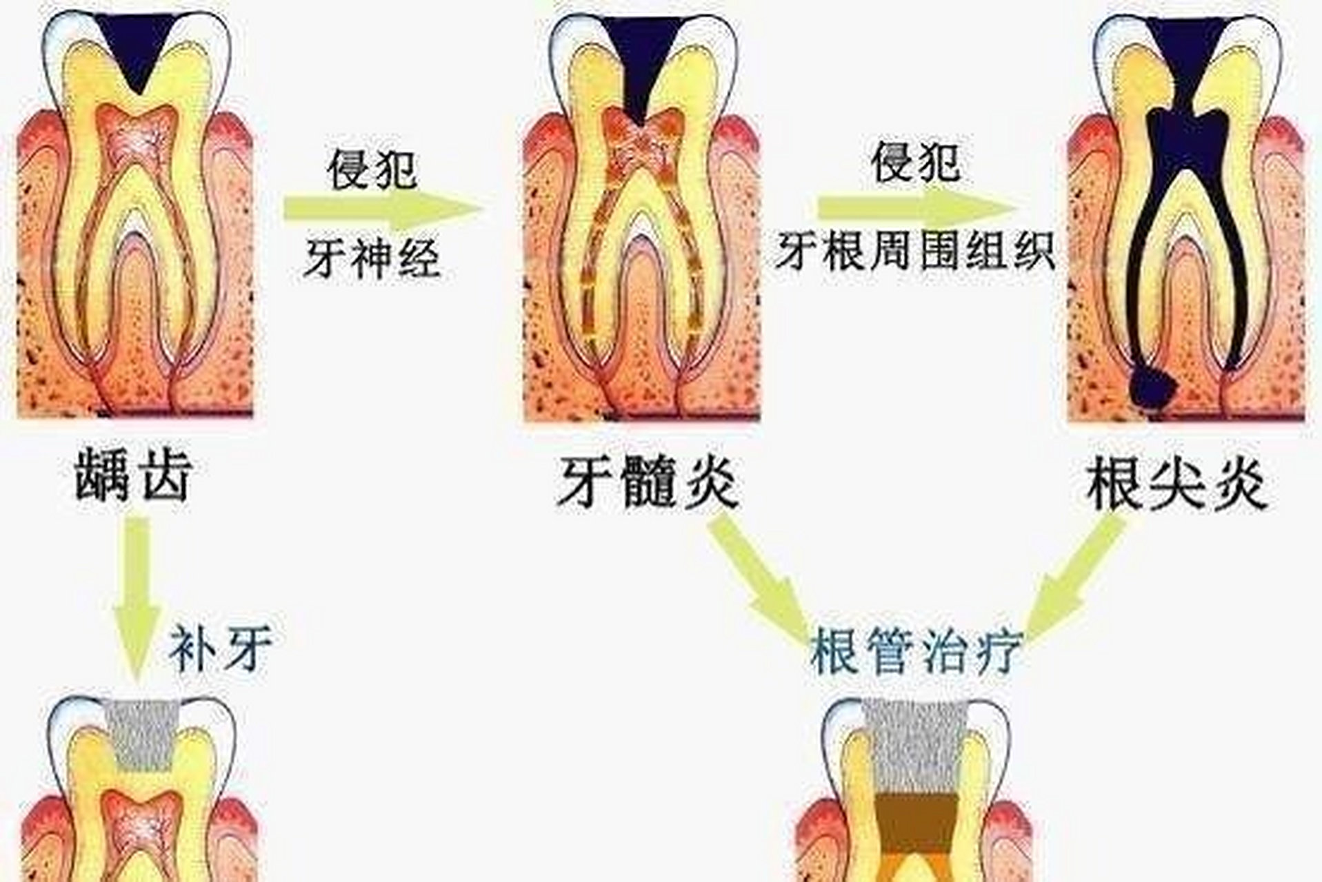 929292【文章有点长请您耐心看完】  166什么是牙神经 牙