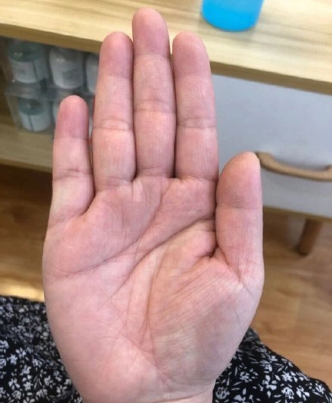 天纹感情线延伸到食指中指之间 需注意因过于信任别人而受到拖累.