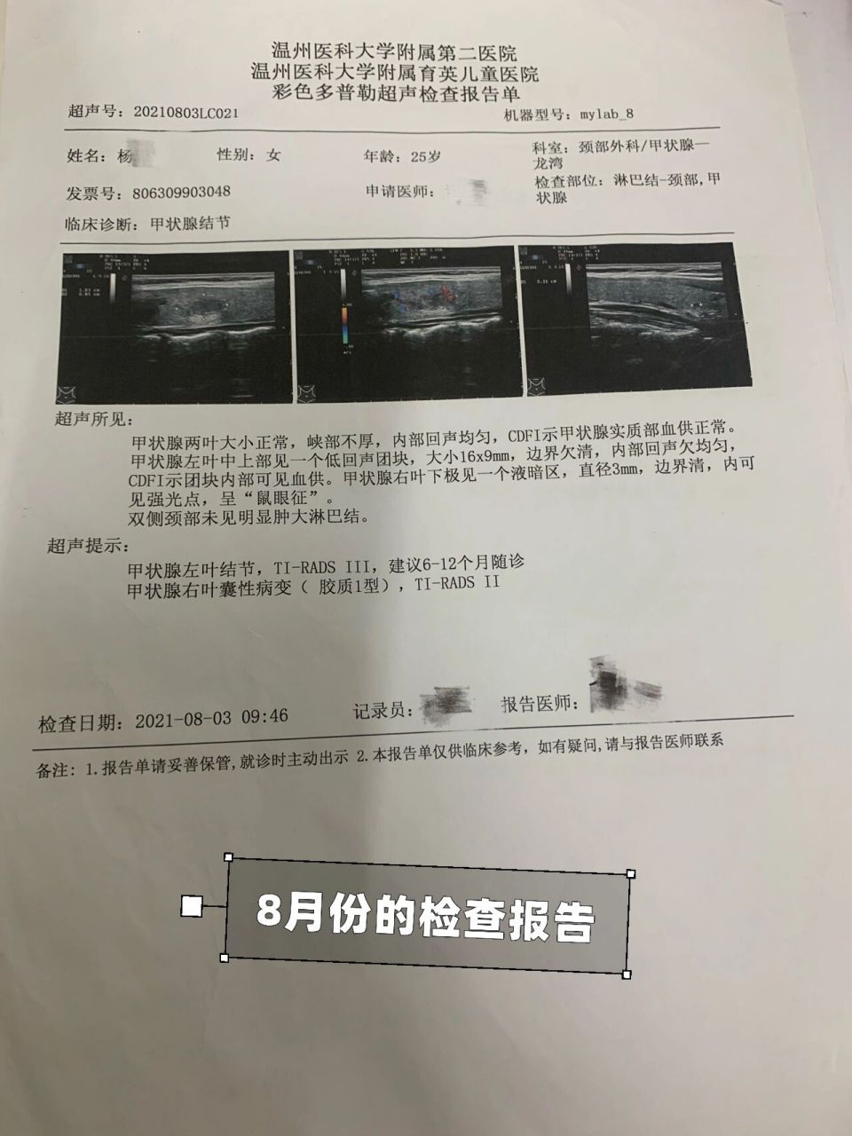 3个月甲状腺结节三级到确诊甲状腺乳头状癌 今年公司历年体检我检查出