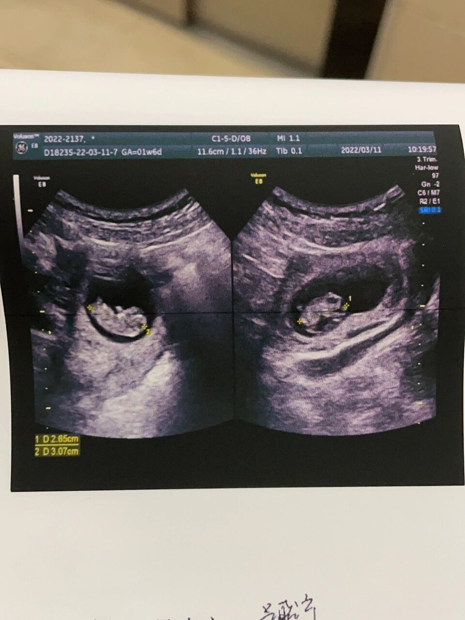 彩超,接下来就是nt啦