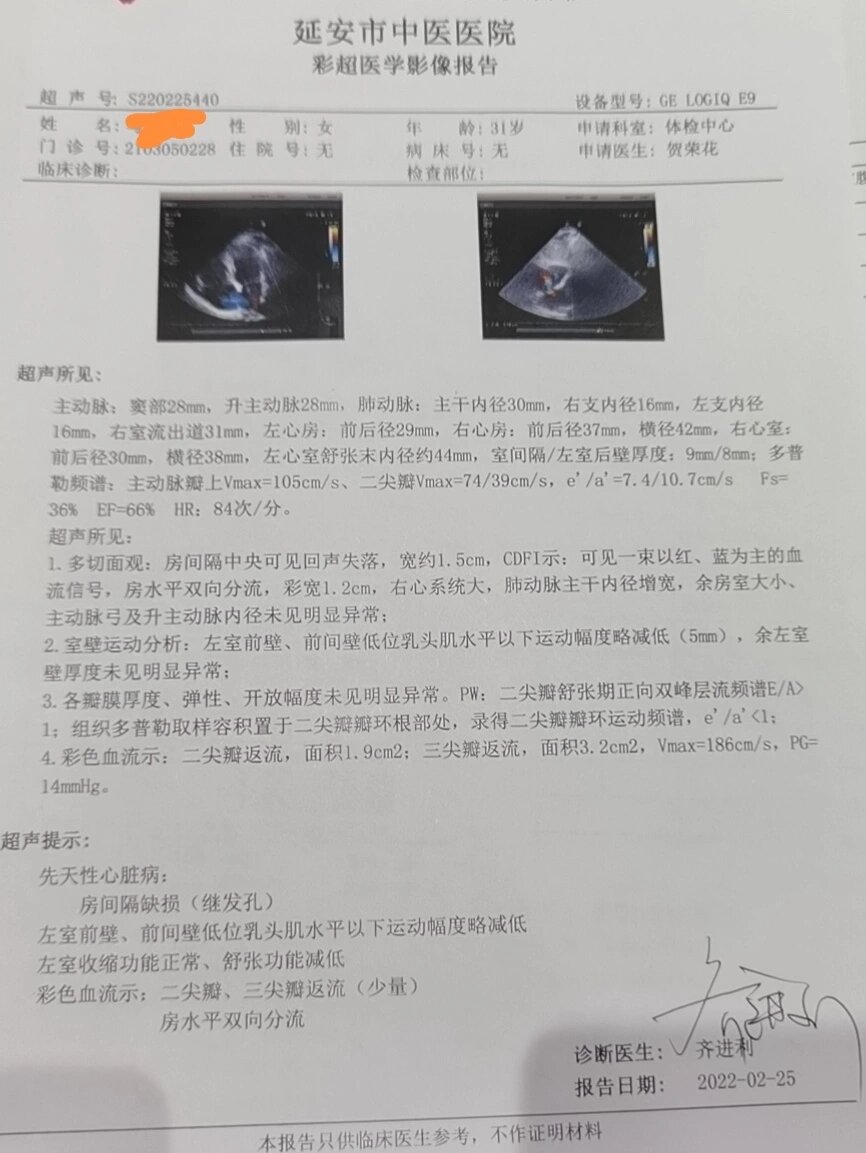 房间隔缺损