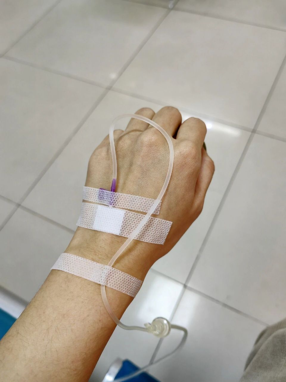 中间有冲管,每天都在变重食量也没什么变化,有点疑惑是不是储水导致的