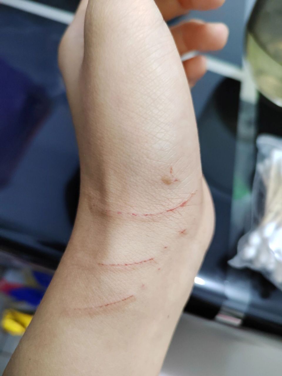 被养了两个月的流浪猫挠了咋办 抓他脖子给他弄疼