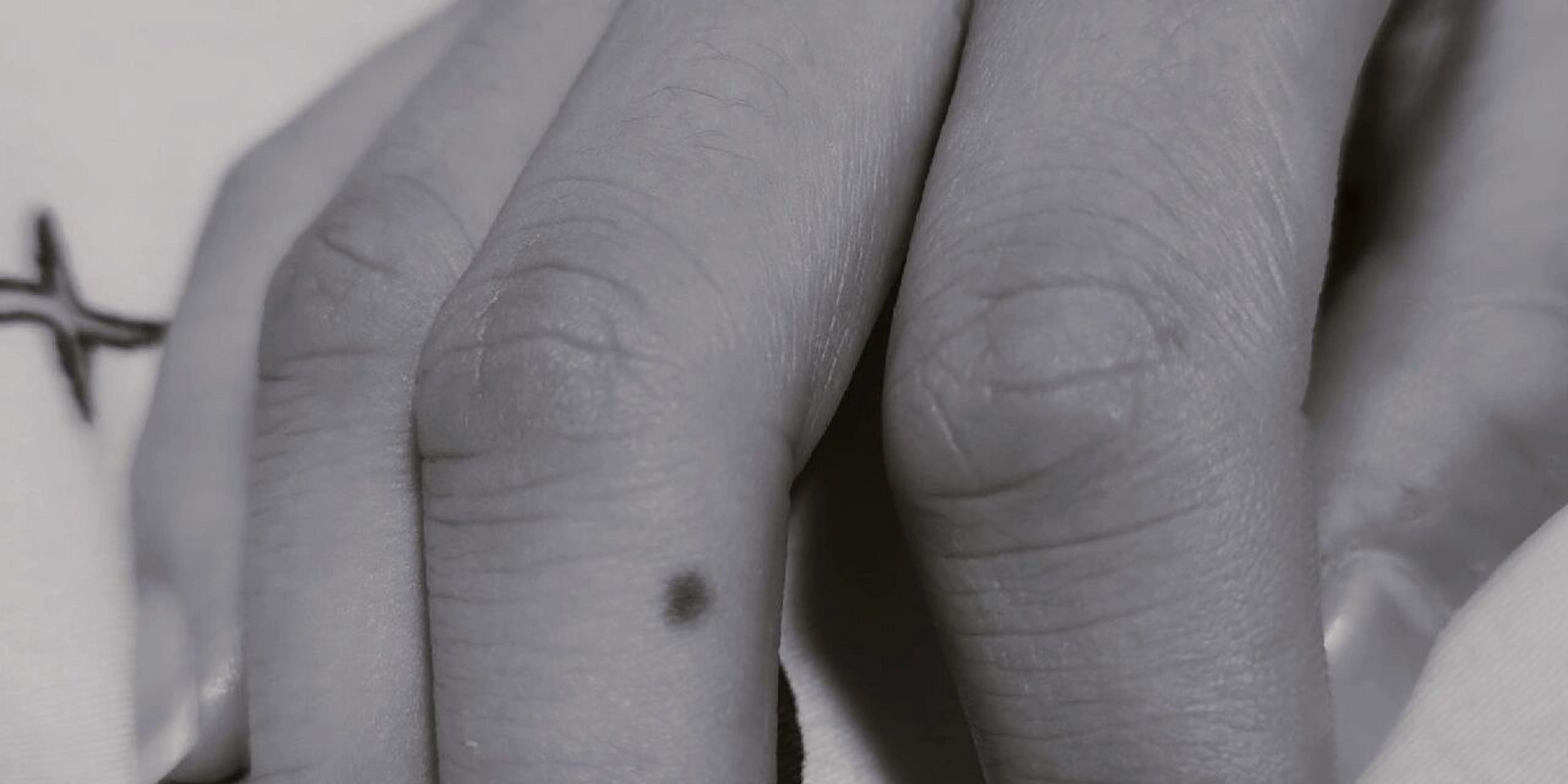 中指的痣到底代表什么呢? 谁能告诉我这是什么意思