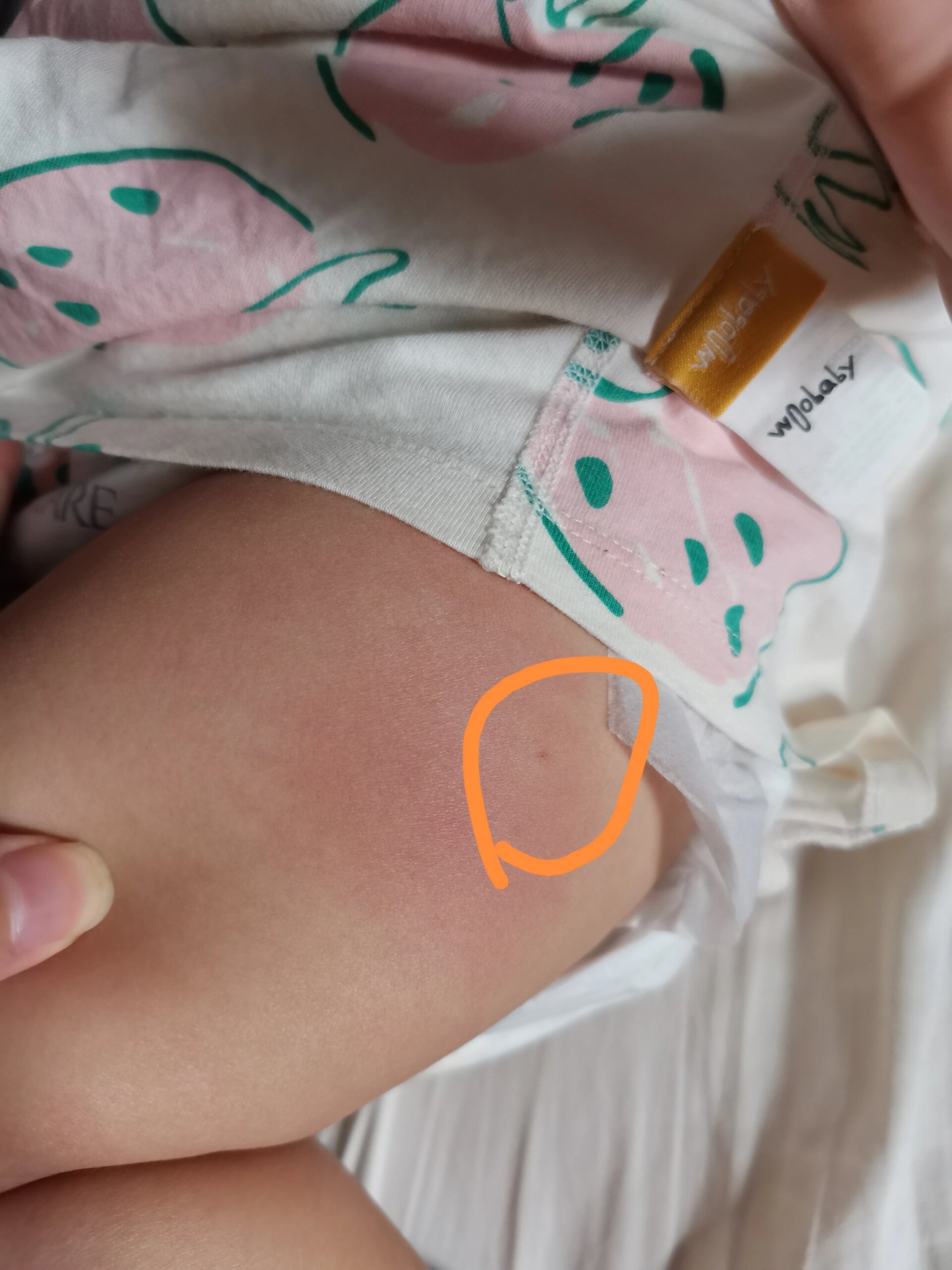 疫苗打大腿位置 请问在大腿注射疫苗,可以打到这么高的位置吗?
