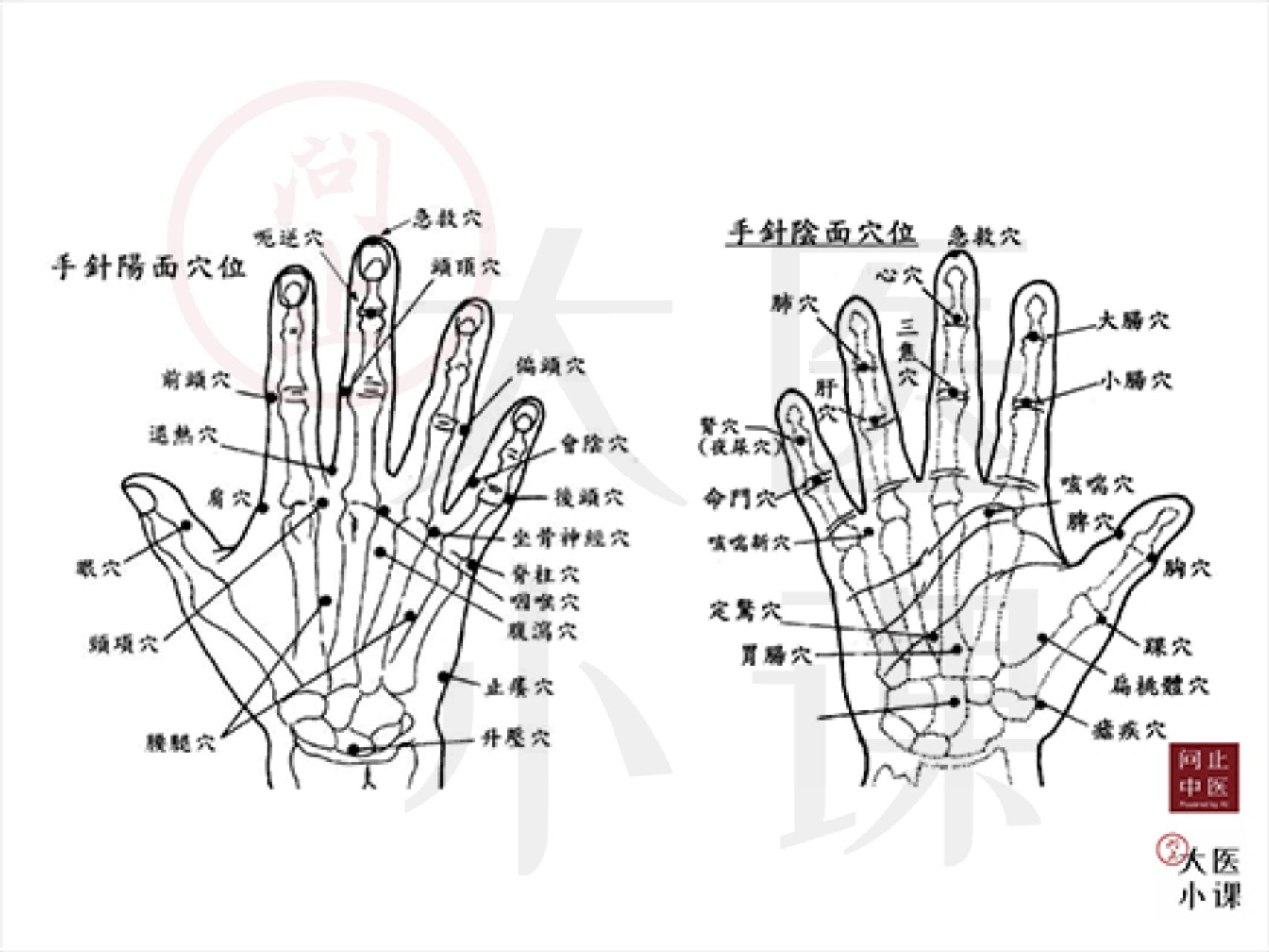 针灸手上位置图图片