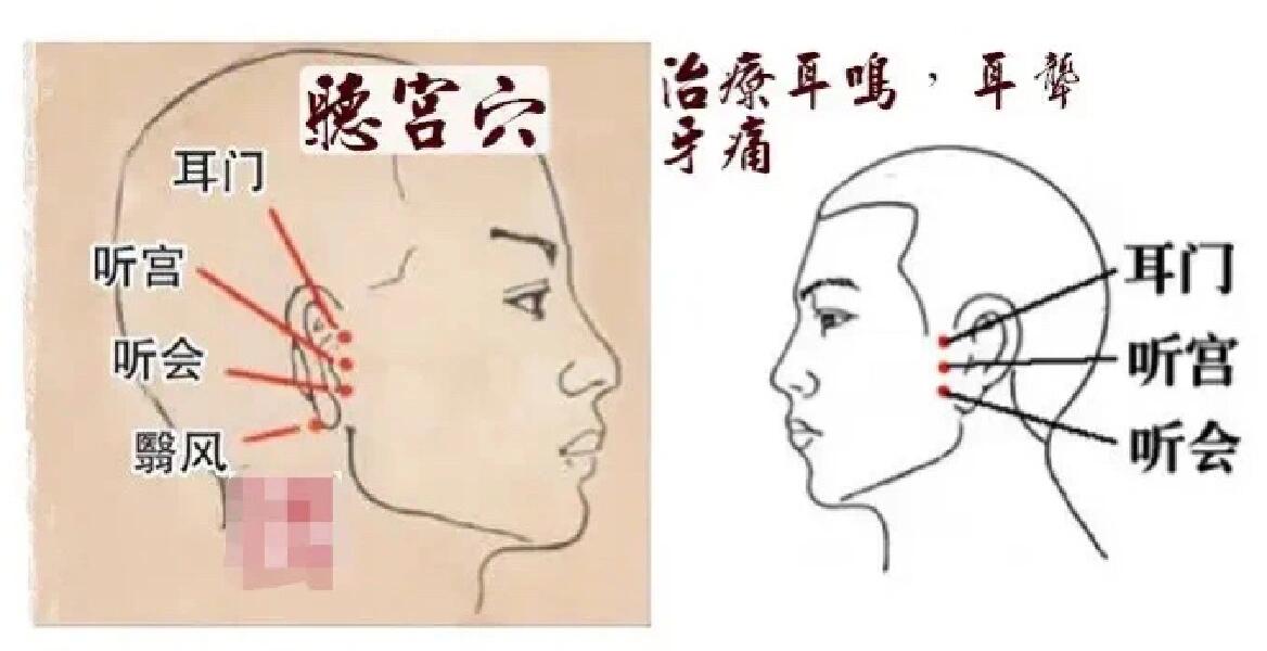 如果出现耳鸣症状