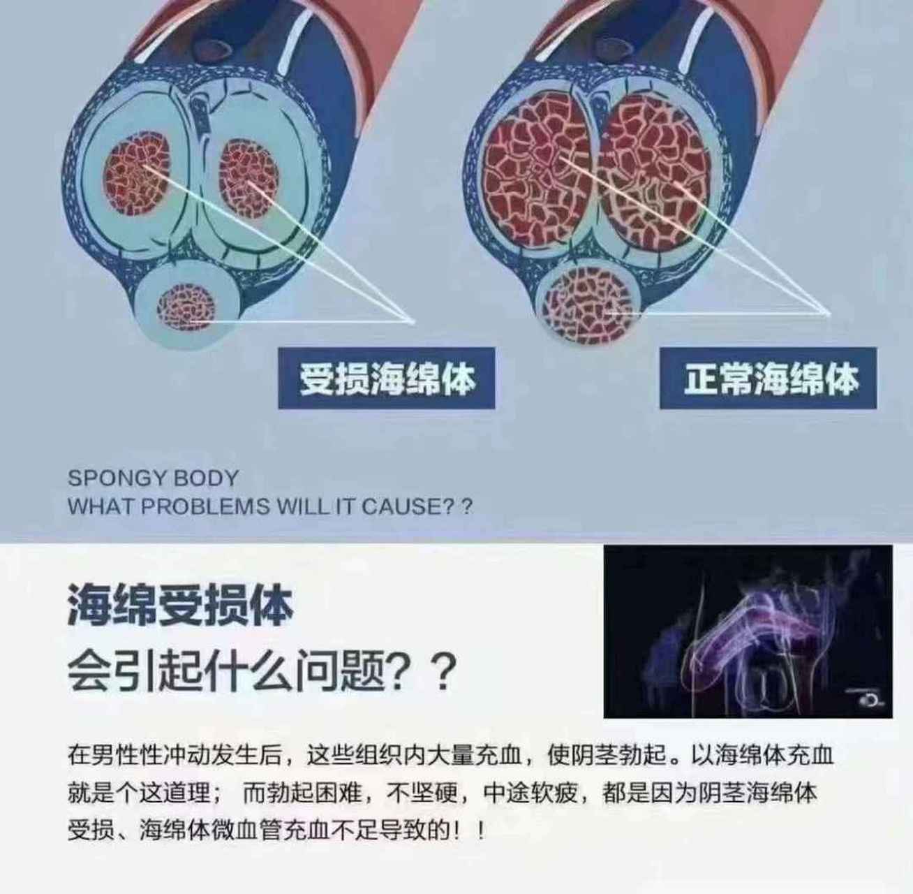 潍坊长安男科医院科普:海绵体受损是没有自愈能力的,你要么调理修复