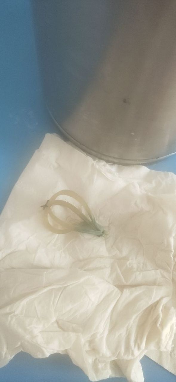 肛周脓肿第九天,皮筋终于让我拽下来了.逃过了紧线的痛苦.