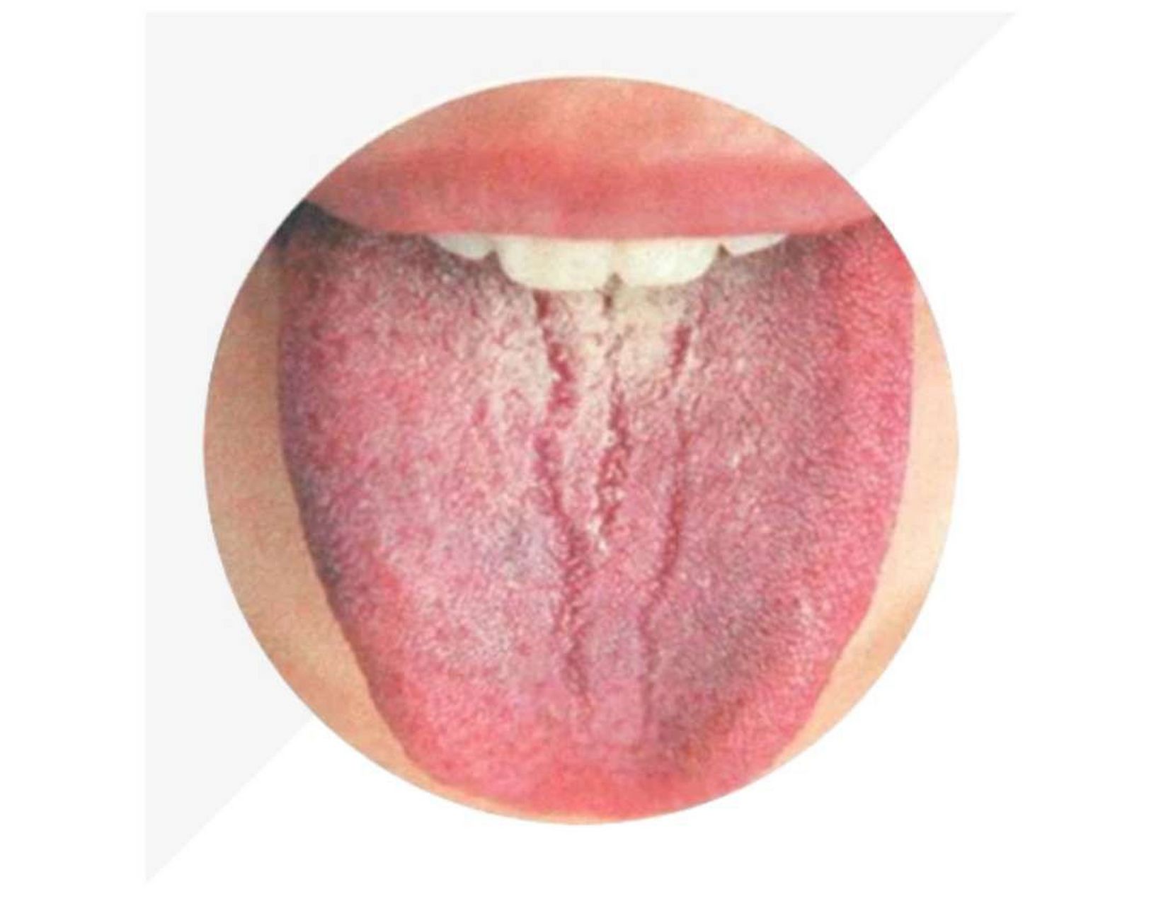 助孕知识!精血亏虚是什么原因造成的"喜气洋洋"-第1张图片-小宝网