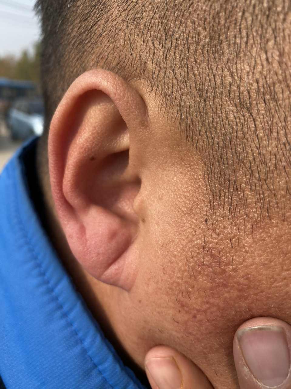 关于耳朵上出现的某种预示心脏健康状况的纹路,许多人