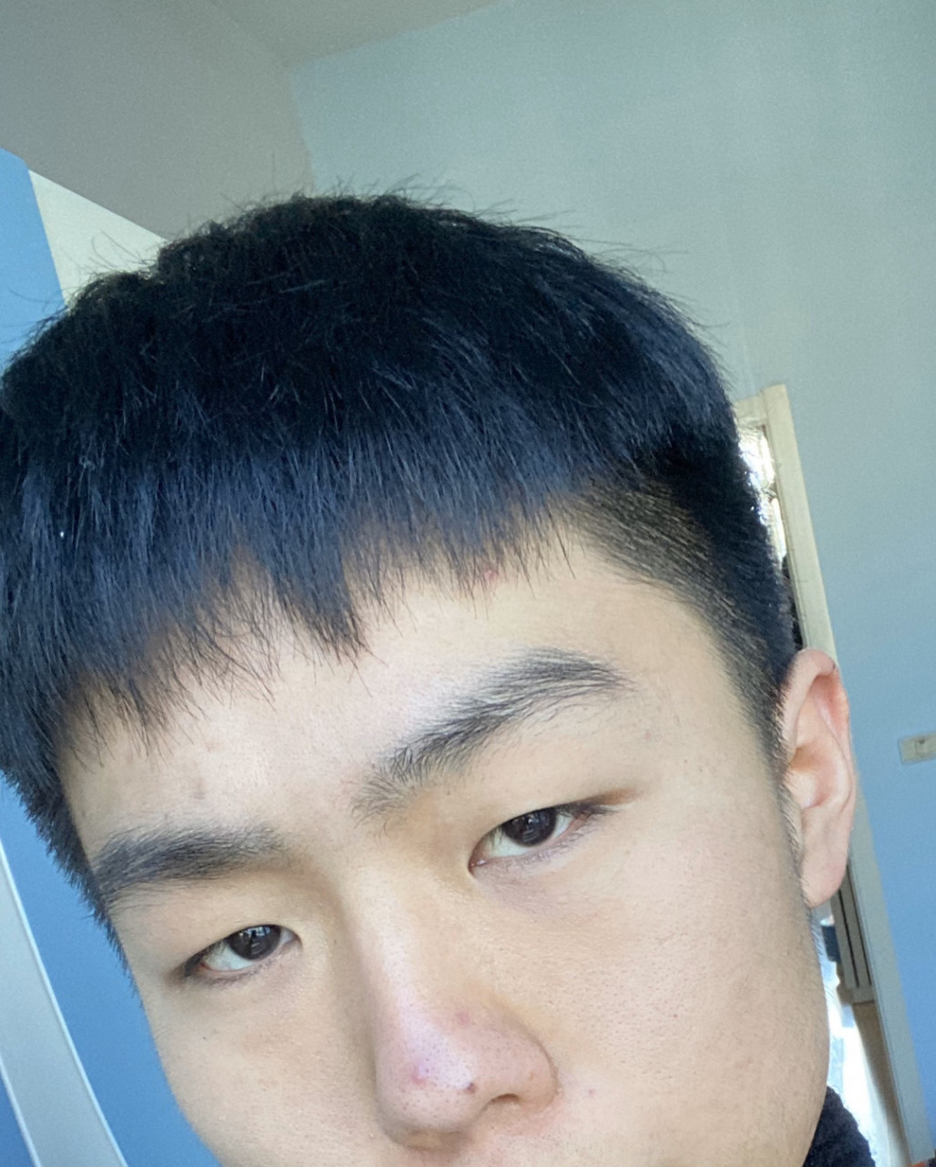 鼻子挤完痘痘20天了 有个凸起的小包都没下去 是不是增生性痘疤啊 不