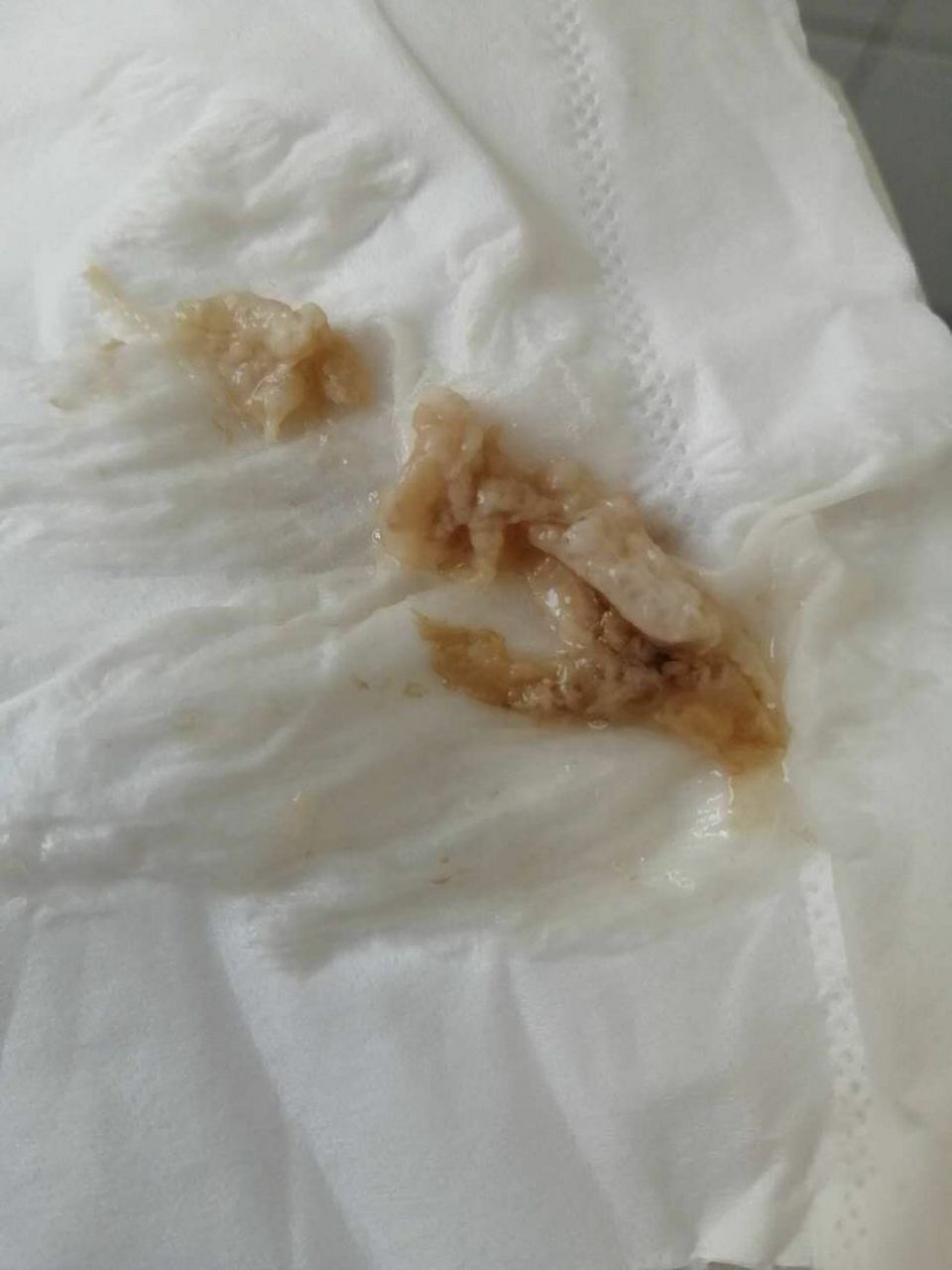 用了私护产品四支,排出这种垃圾.