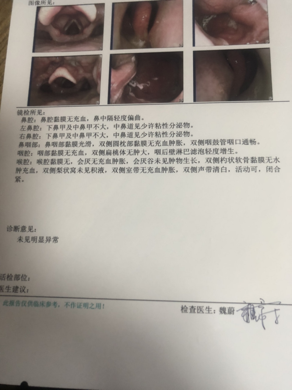 脸颊滚烫,我很担心,因为刚知道了还有一种癌叫鼻窦癌.