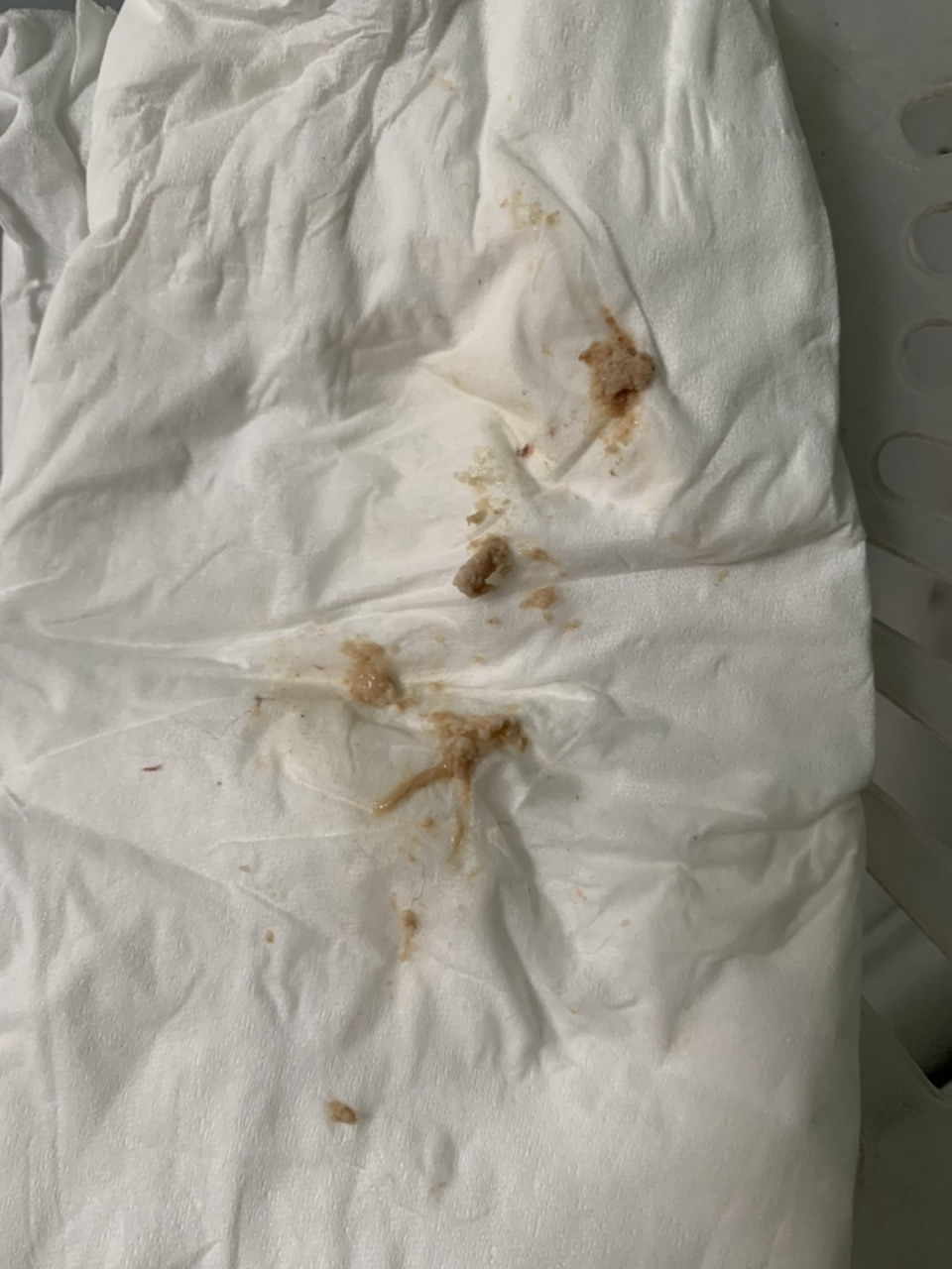 用私护凝胶第三天排出来的