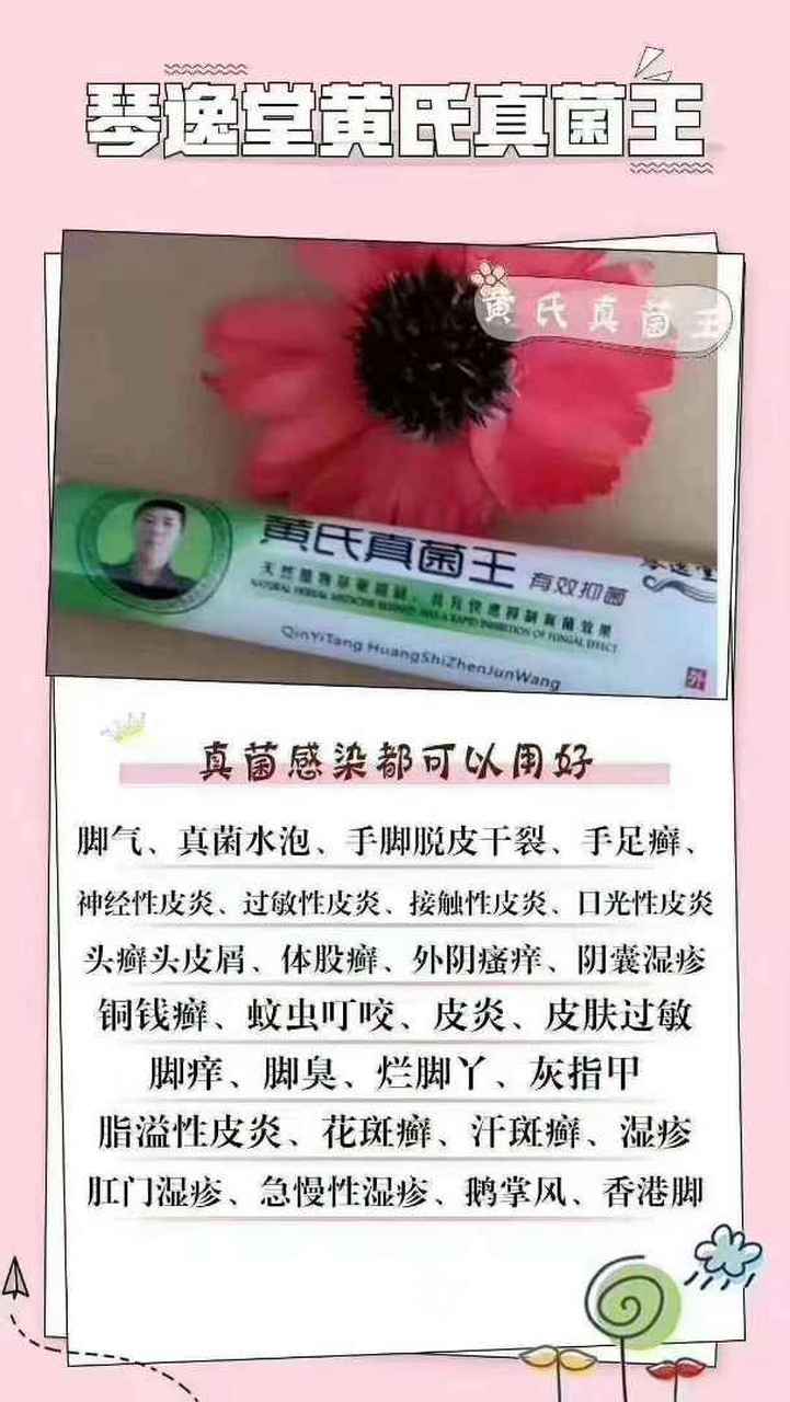 我尴尬的起鸡皮疙瘩了(我起鸡皮疙瘩了怎么回复)