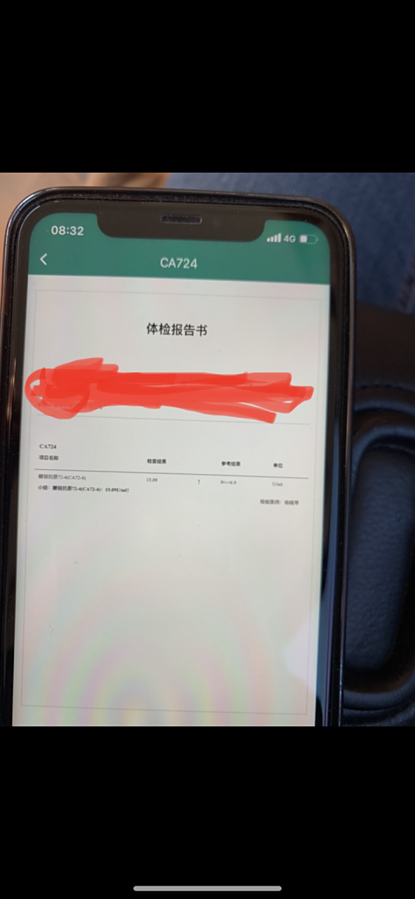 ca72-4持续升高怎么办?