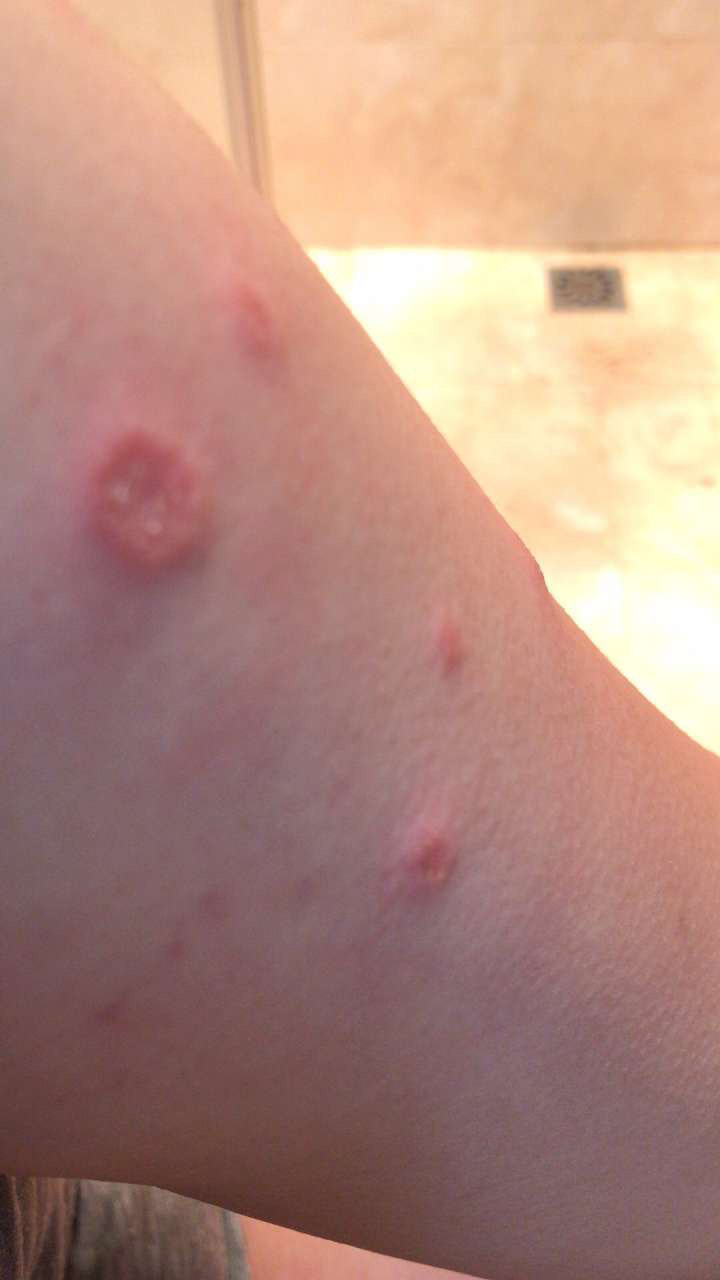 快快救救孩子吧,猫藓越来越严重,家里面一大堆药就是不管用,现在晒